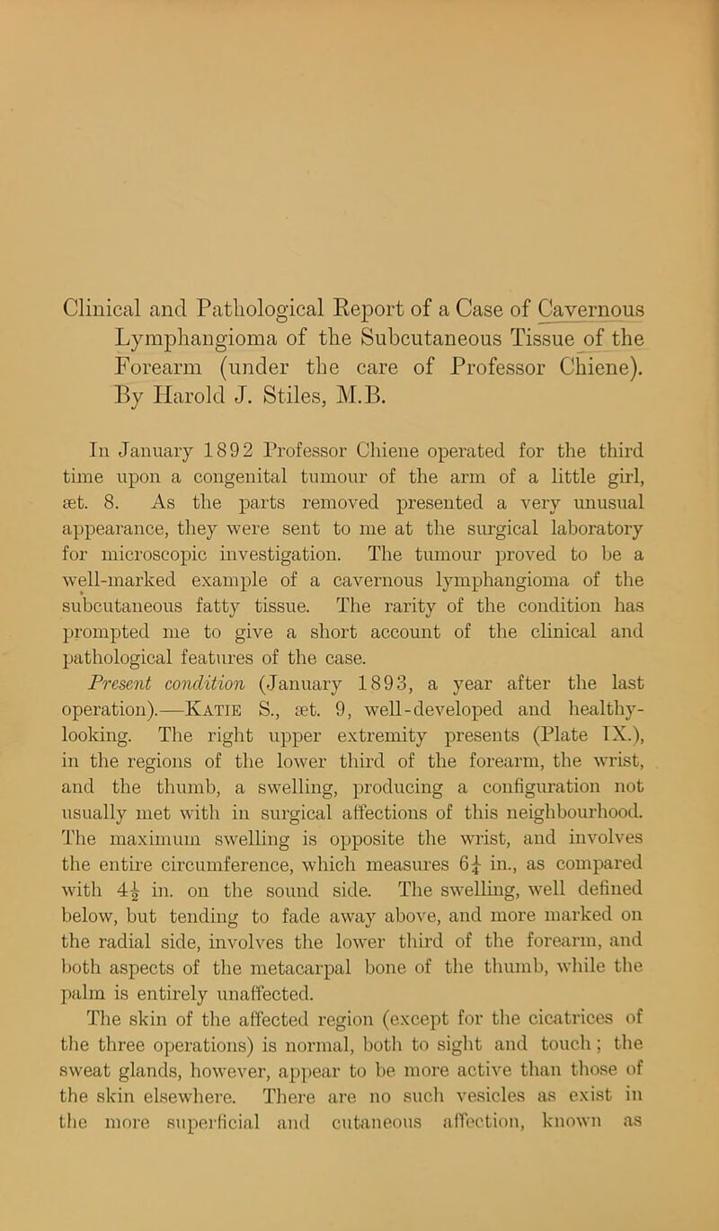 Clinical and Pathological Report of a Case of Cavernous Lymphangioma of the Subcutaneous Tissue of the Forearm (under the care of Professor Chiene). By Harold J. Stiles, M.B. In January 1892 Professor Chiene operated for the thud time upon a congenital tumour of the arm of a little girl, set. 8. As the parts removed presented a very unusual appearance, they were sent to me at the surgical laboratory for microscopic investigation. The tumour proved to be a well-marked example of a cavernous lymphangioma of the subcutaneous fatty tissue. The rarity of the condition has prompted me to give a short account of the clinical and pathological features of the case. Present condition (January 1893, a year after the last operation).—Katie S., set. 9, well-developed and healthy - looking. The right upper extremity presents (Plate IX.), in the regions of the lower third of the forearm, the wrist, and the thumb, a swelling, producing a configuration not usually met with in surgical affections of this neighbourhood. The maximum swelling is opposite the wrist, and involves the entire circumference, which measures 6f in., as compared with 4^ in. on the sound side. The swelling, well defined below, but tending to fade away above, and more marked on the radial side, involves the lower third of the forearm, and both aspects of the metacarpal bone of the thumb, while the palm is entirely unaffected. The skin of the affected region (except for the cicatrices of the three operations) is normal, both to sight and touch; the sweat glands, however, appear to be more active than those of the skin elsewhere. There are no such vesicles as exist in the more superficial and cutaneous affection, known as