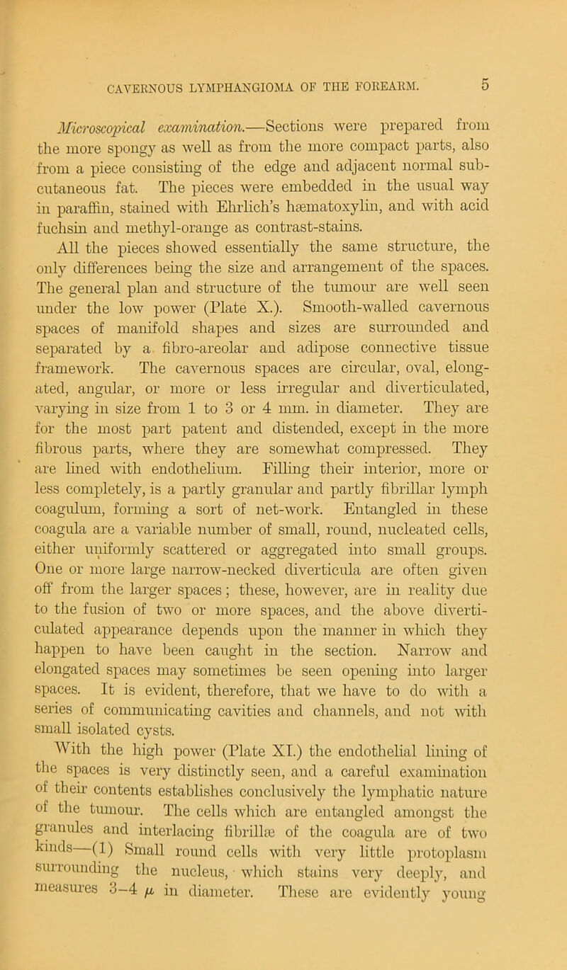 Microscopical examination.—Sections were prepared from the more spongy as well as from the more compact parts, also from a piece consisting of the edge and adjacent normal sub- cutaneous fat. The pieces were embedded in the usual way in paraffin, stained with Ehrlich’s hsematoxylin, and with acid fnchain and methyl-orange as contrast-stains. All the pieces showed essentially the same structure, the only differences being the size and arrangement of the spaces. The general plan and structure of the tumour are well seen under the low power (Plate X.). Smooth-walled cavernous spaces of manifold shapes and sizes are surrounded and separated by a fibro-areolar and adipose connective tissue framework. The cavernous spaces are circular, oval, elong- ated, angular, or more or less irregular and diverticulated, varying in size from 1 to 3 or 4 mm. in diameter. They are for the most part patent and distended, except in the more fibrous parts, where they are somewhat compressed. They are lined with endothelium. Filling their interior, more or less completely, is a partly granular and partly fibrillar lymph coagulum, forming a sort of net-work. Entangled hi these coagula are a variable number of small, round, nucleated cells, either uniformly scattered or aggregated into small groups. One or more large narrow-necked diverticula are often given off from the larger spaces; these, however, are in reality due to the fusion of two or more spaces, and the above diverti- culated appearance depends upon the manner in which they happen to have been caught in the section. Narrow and elongated spaces may sometimes be seen opening into larger spaces. It is evident, therefore, that we have to do with a series of communicating cavities and channels, and not with small isolated cysts. With the high power (Plate XI.) the endothelial lining of the spaces is very distinctly seen, and a careful examination of then- contents establishes conclusively the lymphatic nature of the tumour. The cells which are entangled amongst the granules and interlacing librilhc of the coagula are of two kinds (1) Small round cells with very little protoplasm surrounding the nucleus, which stains very deeply, and measures 3—4 fx, in diameter. These are evidently young