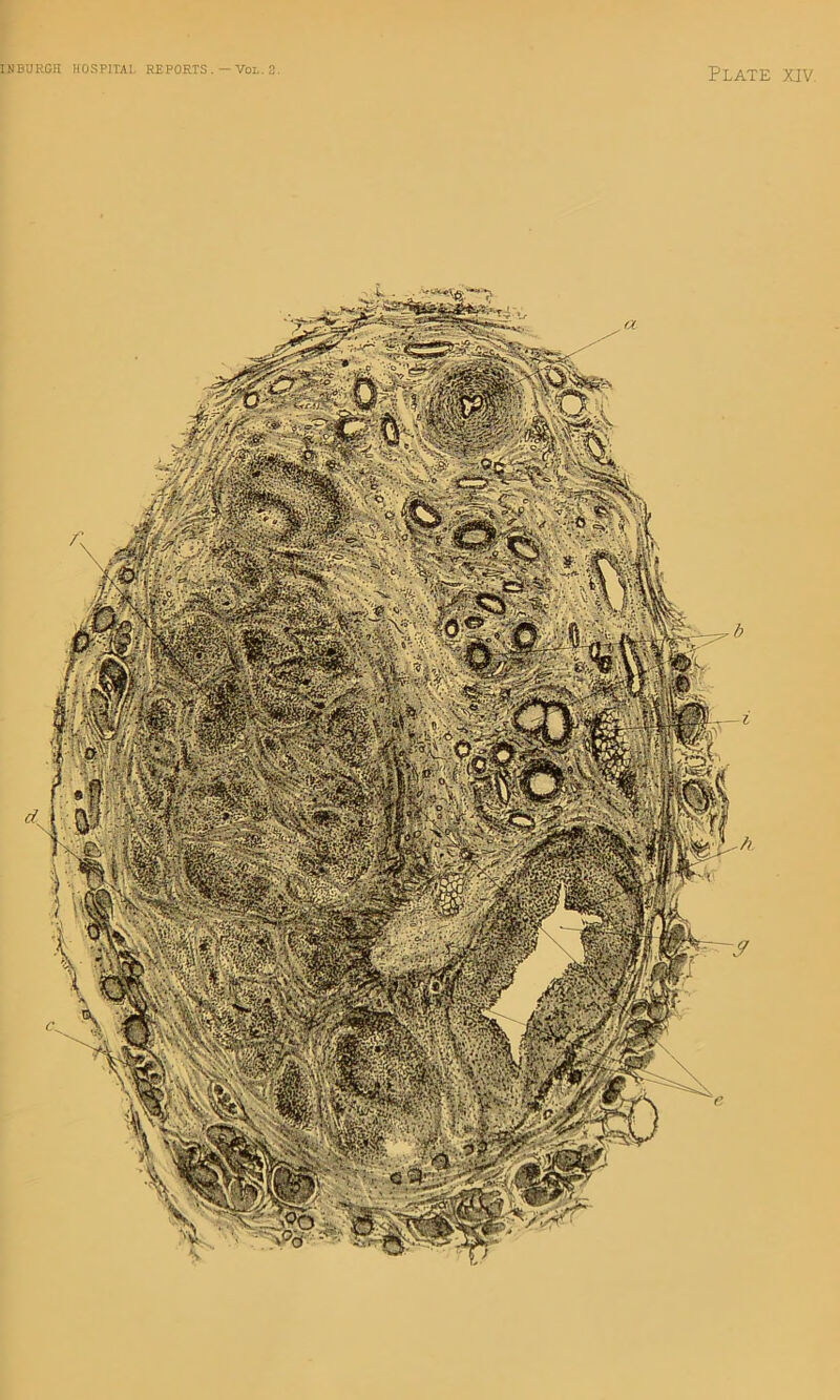 IMBURGII HOSPITAI. REPORTS . ~ VoL.
