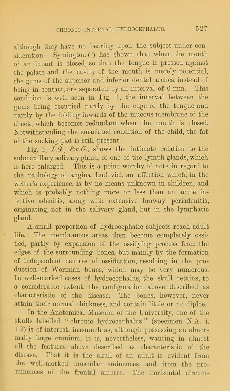 although they have no bearing upon the subject under con- sideration. Symington (‘^) has shown that when the mouth of an infant is closed, so that the tongue is pressed against the palate and the cavity of the mouth is merely potential, the gums of the superior and inferior dental arches, instead of being in contact, are separated by an interval of 6 mm. This condition is well seen in Fig. 1, the interval between the gums being occupied partly by the edge of the tongue and partly by the folding inwards of the mucous membrane of the cheek, which becomes redundant when the mouth is closed. Notwithstanding the emaciated condition of the child, the fat of the sucking pad is still present. Fis. 2, L.G., Sm.G., shows the intimate relation to the submaxillary salivary gland, of one of the lymph glands, which is here enlarged. This is a point worthy of note in regard to the pathology of angina Ludovici, an affection which, in the writer’s experience, is by no means unknown in children, and which is probably nothing more or less than an acute in- fective adenitis, along with extensive brawny periadenitis, originating, not in the salivary gland, but in the lymphatic gland. A small proportion of hydrocephalic subjects reach adult life. The membranous areas then become completely ossi- fied, partly by expansion of the ossifying process from the edges of the surrounding bones, but mainly by the formation of independent centres of ossification, resulting in the pro- duction of Wormian bones, which may be very numerous. In well-marked cases of hydrocephalus, the skull retains, to a considerable extent, the configuration above described as characteristic of the disease. The bones, however, never attain their normal thickness, and contain little or no diploe. In the Anatomical Museum of the University, one of the skulls labelled “ chronic hydrocephalus ” (specimen N.A. i. 12) is of interest, inasmuch as, although possessing an abnor- mally large cranium, it is, nevertheless, wanting in almost all the features above described as characteristic of the disease. That it is the skull of an adult is evident from the well-marked muscular eminences, and from the pro- minences of the frontal sinuses. The horizontal circuin-