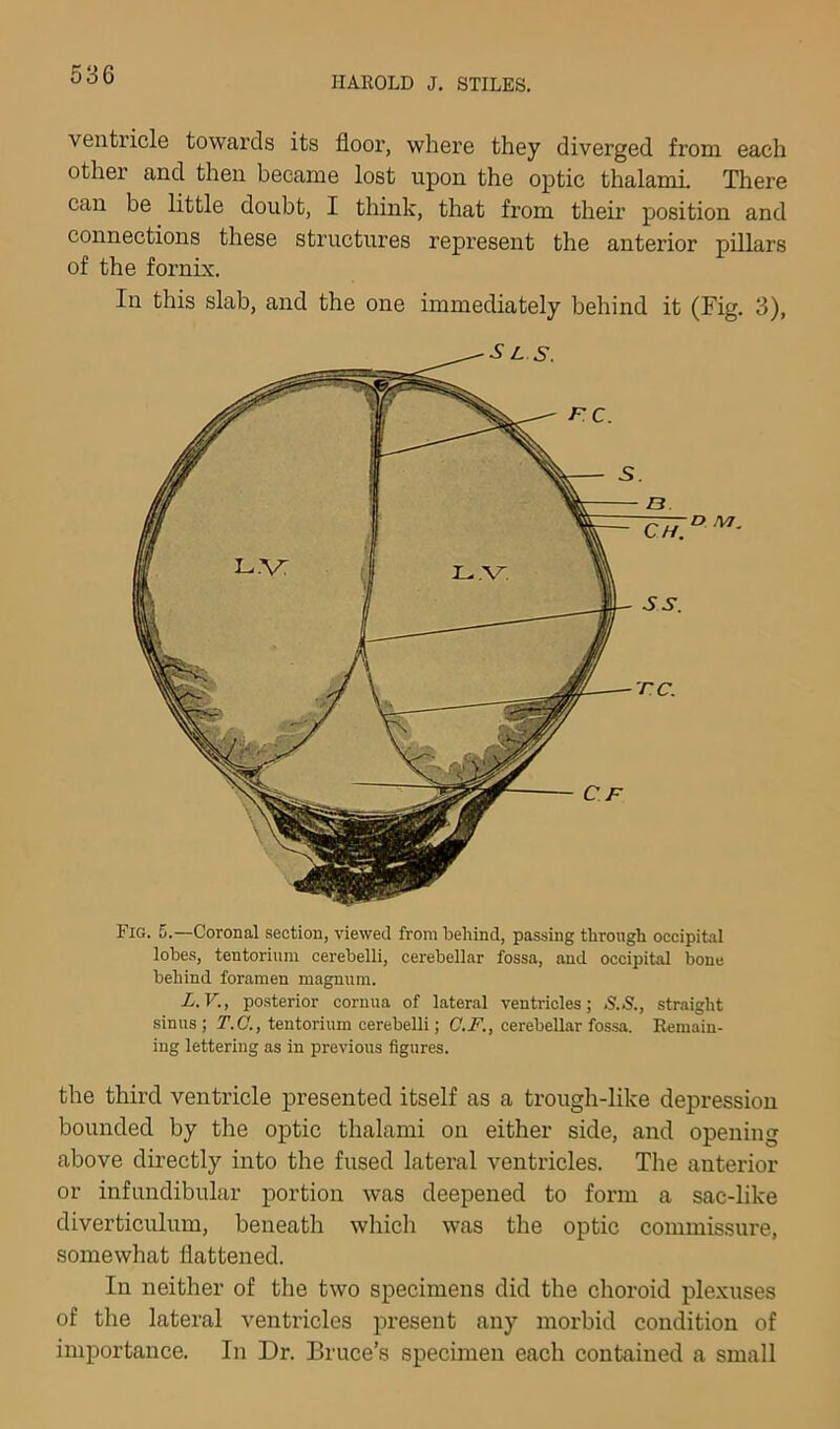 HAROLD J, STILES. ventricle towards its floor, where they diverged from each other and then became lost upon the optic thalami. There can be little doubt, I think, that from their position and connections these structures represent the anterior pillars of the fornix. In this slab, and the one immediately behind it (Fig. 3), Fig. 5.—Coronal section, viewed from behind, passing through occipital lobes, tentorium cerebelli, cerebellar fossa, and occipital bone behind foramen magnum. L.V., posterior cornua of lateral ventricles; S.S., straight sinus ; T.C., tentorium cerebelli; G.F., cerebellar fossa. Remain- ing lettering as in previous figures. the third ventricle presented itself as a trough-like depi’essiou bounded by the optic thalami on either side, and opening above directly into the fused lateral ventricles. The anterior or infundibular portion was deepened to form a sac-like diverticulum, beneath which was the optic commissure, somewhat flattened. In neither of the two specimens did the choroid plexuses of the lateral ventricles present any morbid condition of importance. In Dr. Bruce’s specimen each contained a small