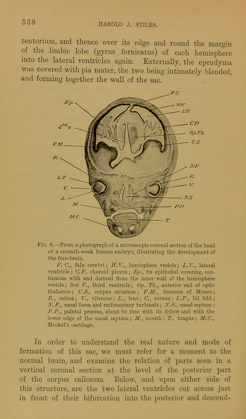 tentorium, and thence over its edge and round the margin of the limbic lobe (gyrus fornicatus) of each hemisphere into the lateral ventricles again. Externally, the ependyma was covered with pia mater, the two being intimately blended, and forming together the wall of the sac. Fig. 6.—From a jiliotograpli of a microscopic coronal section of the head of a seventh-week human embryo, illustrating the development of the fore-brain. F. Q., falx cerebri; H.V., hemisphere ve.sicle; L.V., lateral ventricle ; O.F. choroid plexus; Ep., its epithelial covering, con- tinuous with and derived from the inner waU of the hemisphere vesicle; 3rd V., third ventricle; Op. Th., anterior end of optic thalamus; C.S., corpus striatum; F.M., foramen of Monro; R., retina; F., vitreous; L., lens; G., cornea; L.F., lid fold; N.F., nasal fossa and rudimentary turbinals ; F.S., nasal septum ; P.P., palatal process, about to fuse with its fellow and with the lower edge of the nasal seiitum; M., mouth; T., tongue; M.C., Meckel’s cartilage. In order to understand the real nature and mode of formation of this sac, we must refer for a moment to the normal brain, and examine the relation of parts seen in a vertical coronal section at the level of the posterior part of the corpus callosum. Below, and upon either side of this structure, are the two lateral ventricles cut across just in front of their bifurcation into the posterior and descend-