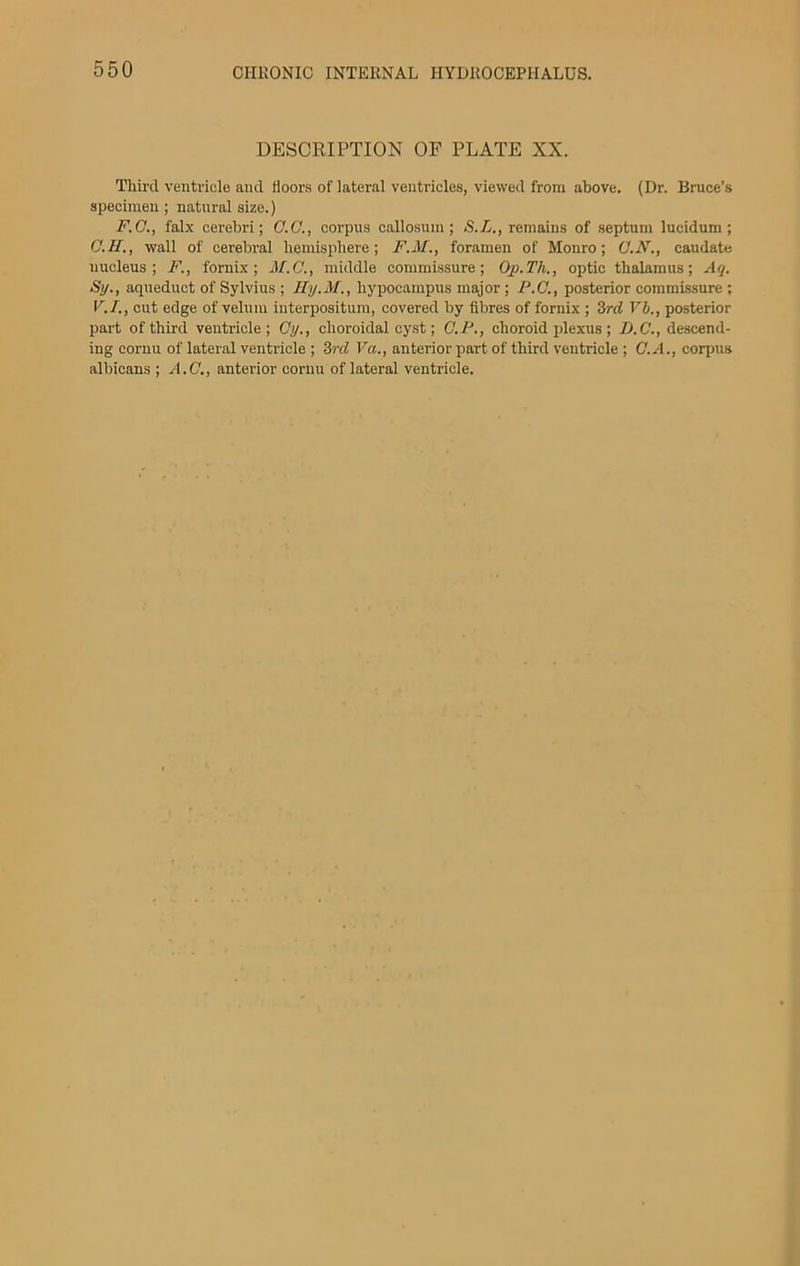 DESCRIPTION OF PLATE XX. Third ventricle and floors oflateral ventricles, viewed from above. (Dr. Bruce’.s specimen; natural size.) F.G., falx cerebri; G.Q., corpus callosum; S.L., remains of septum lucidum ; G.U., wall of cerebral hemisphere; F.M., foramen of Monro; G.N., caudate nucleus; F., fornix; M.G., middle commissure; Op.Th., optic thalamus; Aq. Si/., aqueduct of Sylvius ; Ily.M., hypocampus major ; P.G., posterior commissure ; V.I., cut edge of velum interpositum, covered by fibres of fornix ; 3rd Vb., posterior part of third ventricle; Gy., choroidal cyst; G.F., choroid ifiexus; D.G., descend- ing cornu of lateral ventricle ; 3rd Va., anterior part of third ventricle ; G.A., corpiis albicans ; A.G., anterior cornu oflateral ventricle.