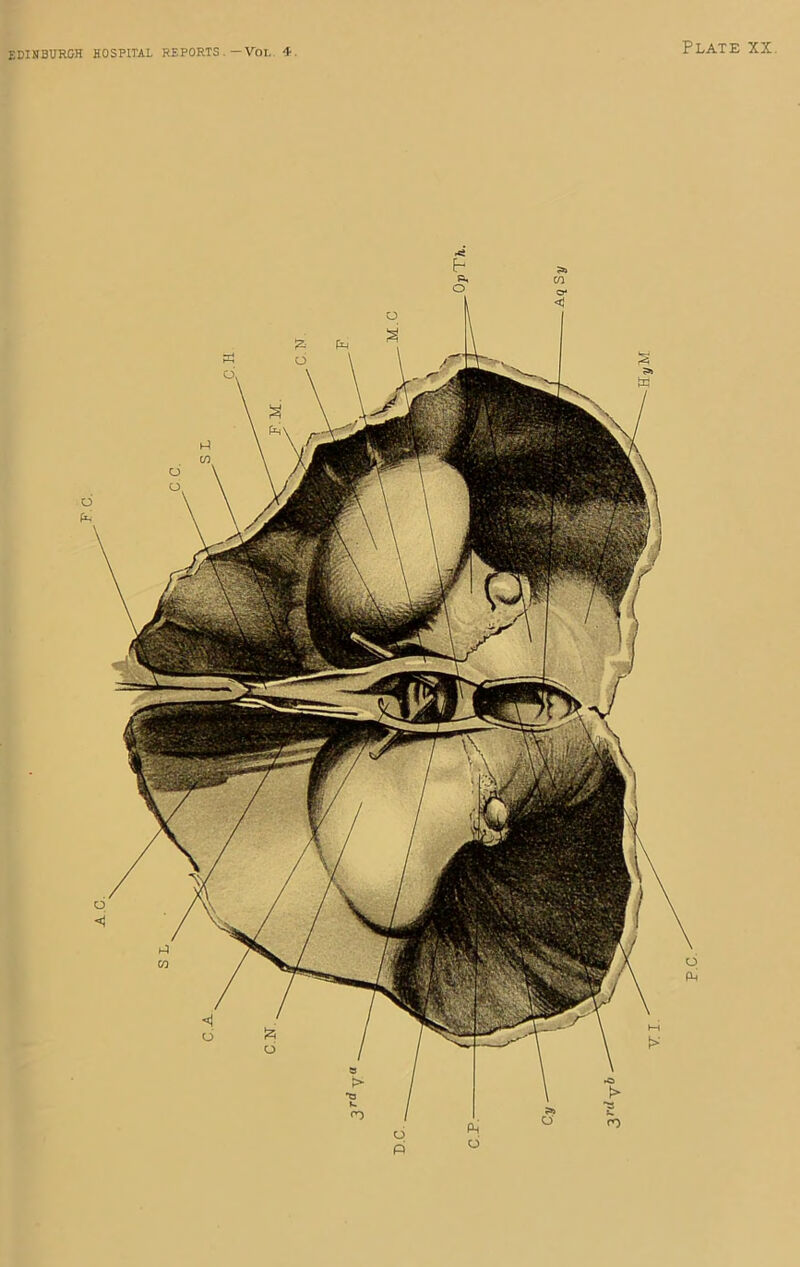 AC. EDIHBUH&H hospital reports.—Voi,. “T. Plate xx. v.l