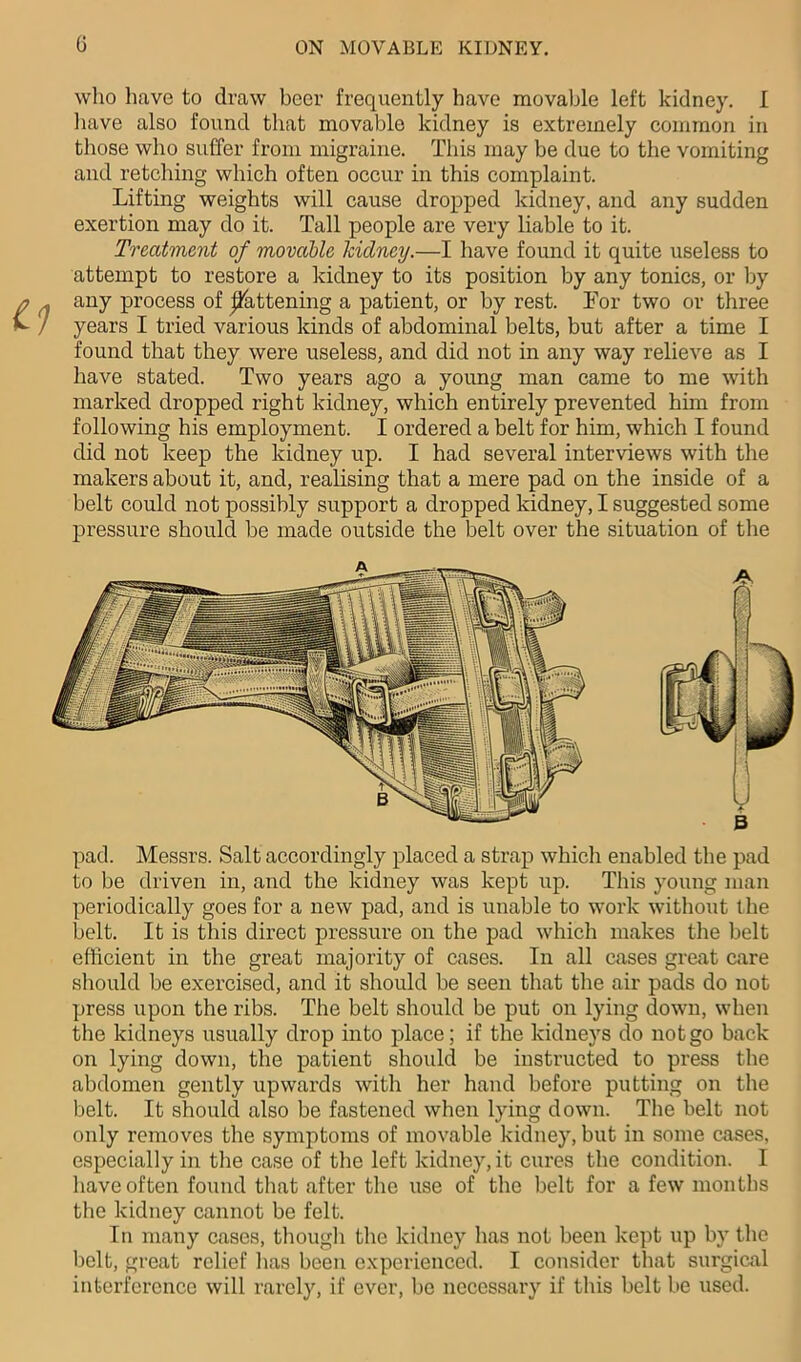 who have to draw beer frequently have movable left kidney. I have also found that movable kidney is extremely common in those who suffer from migraine. This may be due to the vomiting and retching which often occur in this complaint. Lifting weights will cause dropped kidney, and any sudden exertion may do it. Tall people are very liable to it. Treatment of movable kidney.—I have found it quite useless to attempt to restore a kidney to its position by any tonics, or by any process of fattening a patient, or by rest. Tor two or three years I tried various kinds of abdominal belts, but after a time I found that they were useless, and did not in any way relieve as I have stated. Two years ago a young man came to me with marked dropped right kidney, which entirely prevented him from following his employment. I ordered a belt for him, which I found did not keep the kidney up. I had several interviews with the makers about it, and, realising that a mere pad on the inside of a belt could not possibly support a dropped kidney, I suggested some pressure should be made outside the belt over the situation of the B pad. Messrs. Salt accordingly placed a strap which enabled the pad to be driven in, and the kidney was kept up. This young man periodically goes for a new pad, and is unable to work without the belt. It is this direct pressure on the pad which makes the belt efficient in the great majority of cases. In all cases great care should be exercised, and it should be seen that the air pads do not press upon the ribs. The belt should be put on lying down, when the kidneys usually drop into place; if the kidneys do not go back on lying down, the patient should be instructed to press the abdomen gently upwards with her hand before putting on the belt. It should also be fastened when lying down. The belt not only removes the symptoms of movable kidney, but in some cases, especially in the case of the left kidney, it cures the condition. I have often found that after the use of the belt for a few months the kidney cannot be felt. In many cases, though the kidney has not been kept up by the belt, great relief has been experienced. I consider that surgical interference will rarely, if ever, be necessary if this belt be used.