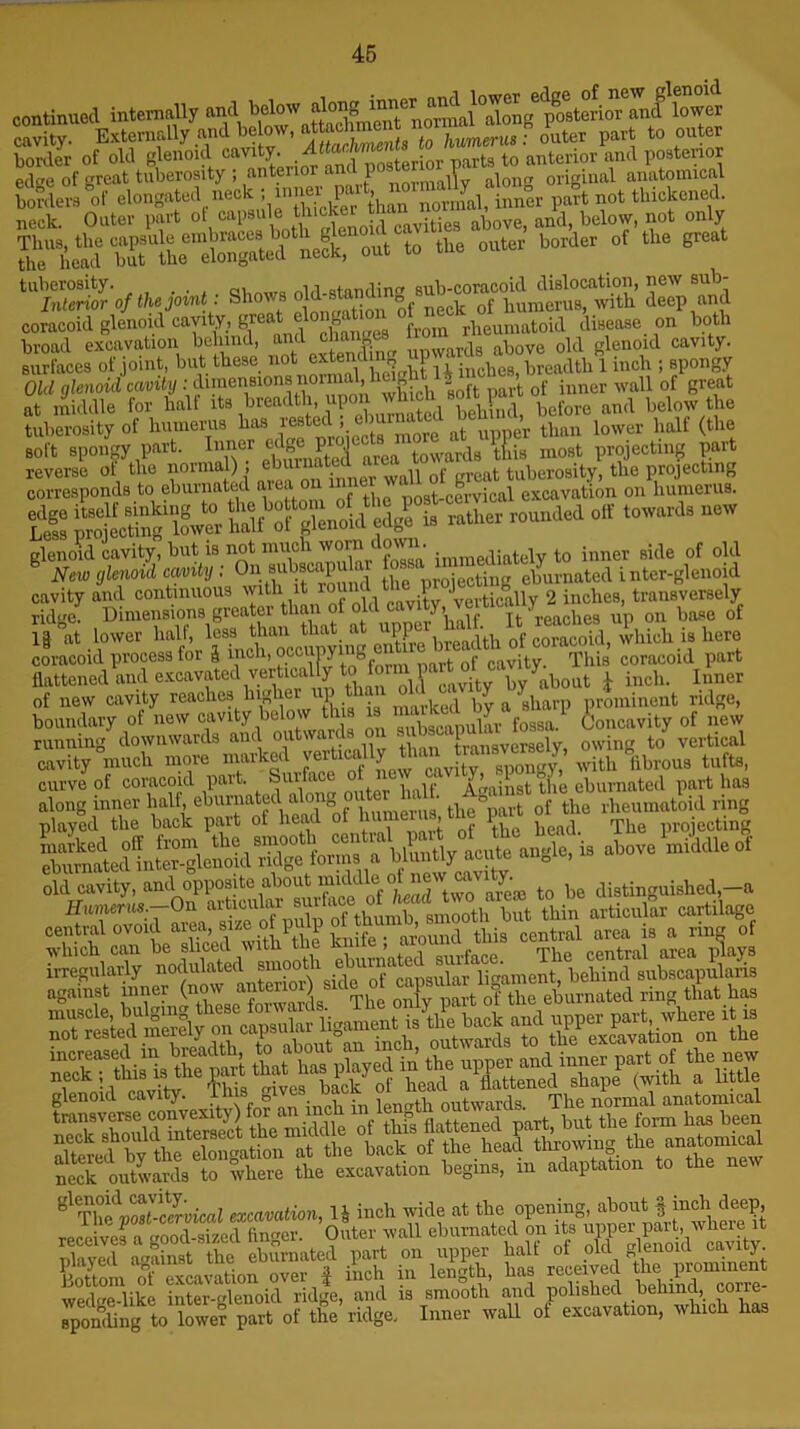 continued internally n™\ anA lowev sas tss, edae of great tuberosity ; anterior and P09t®n ,? lon„ original anatomical borders of elongated neck ! inJl®r P^1 ^ normal, inner part not thickened, neck. Outer part oK''TmJ0diSes above, and, below, not only sis **• —bordet ot the erc,t “SSSv w-: s'-» rP coracoid glenoid cavity, gr £ e8 from rheumatoid disease on both broad excavation behind, 1 F. n-n wards above old glenoid cavity, surfaces of joint, but these not extendmj p “ breadtb i inch ; spongy Old glenoid cavity : dimensions normal, hmghl 4rft of iuner wall of great at middle for halt its breadth, upon beb'ind) before and below the tuberosity of humerus has ieatac > e at upper than lower halt (the soft spongy part. Inner eA« ^ j area towards tEis most projecting part IS S. -led 0,f - - glenoid cavity, but is not much worn 1 own. ■ nljaeclin.tely to inner side of old g New glenoid cavity : °n a^scapular fossa- * elfurnatcd inter-glenoid cavity and continuous Nylth ,lt r°^pl :L vertically 2 inches, transversely ridge. Dimensions greater than of ?t reaches up on base of 1| at lower half, less than that at up l ac{tb 0f coracoid, which is here coracoid process for ft inch, occupying ent f Thig coracoid part flattened and excavated verticalfy ^^^ff^Vabout * inch. Inner of new cavity reaches hi he 1 ‘ , d by a. sharp prominent ridge, boundary ot new cavity below this is markuL y^ ^ i <5oncavity of new running downwards and outward ■ transversely, owing to vertical cavity much more marked vwrticaUy ^th Wus tufts, curve of coracoid part. Suiface ot ne • jb P 1 eburnated part has %urz atf»[ - was toiaiStooidSge forma a idly acute angle, is above middle oi old cavity, and-opposite aboutirnddle1 ofto be distinguished,-a Humerus.—-On articufar cartilage Wmmmmm mmmmm SfeAfbt a * ssl sf