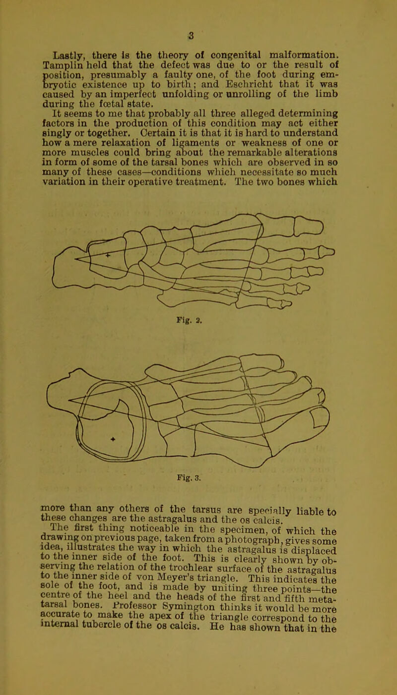 Lastly, there is the theory of congenital malformation. Tamplin held that the defect was due to or the result of position, presumably a faulty one, of the foot during em- bryotic existence up to birth; and Eschricht that it was caused by an imperfect unfolding or unrolling of the limb during the fcetal state. It seems to me that probably all three alleged determining factors in the production of this condition may act either singly or together. Certain it is that it is hard to understand how a mere relaxation of ligaments or weakness of one or more muscles could bring about the remarkable alterations in form of some of the tarsal bones which are observed in so many of these cases—conditions which necessitate so much variation in their operative treatment. The two bones which more than any others of the tarsus are specially liable to these changes are the astragalus and the os calcis. The first thing noticeable in the specimen, of which the drawing on previous page, taken from a photograph, gives some idea, illustrates the way in which the astragalus is displaced to the inner side of the foot. This is clearly shown by ob- serving the relation of the trochlear surface of the astragalus to the inner side of von Meyer’s triangle. This indicate! the sole of the foot, and is made by uniting three points—the centre of the heel and the heads of the first and fifth meta- tarsal bones. Professor Symington thinks it would be more accurate to make the apex of the triangle correspond to the internal tubercle of the os calcis. He has shown that in the