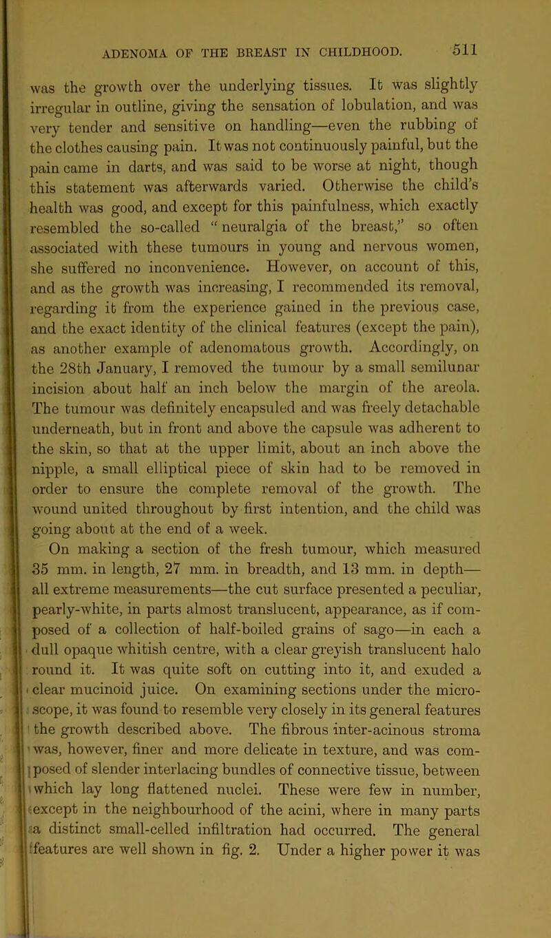 was the growth over the underlying tissues. It was slightly irregular in outline, giving the sensation of lobulation, and was very tender and sensitive on handling—even the rubbing of the clothes causing pain. It was not continuously painful, but the pain came in darts, and was said to be worse at night, though this statement was afterwards varied. Otherwise the child’s health was good, and except for this painfulness, which exactly resembled the so-called “ neuralgia of the breast,” so often associated with these tumours in young and nervous women, she suffered no inconvenience. However, on account of this, and as the growth was increasing, I recommended its removal, regarding it from the experience gained in the previous case, and the exact identity of the clinical features (except the pain), as another example of adenomatous growth. Accordingly, on the 28th January, I removed the tumour by a small semilunar incision about half an inch below the margin of the areola. The tumour was definitely encapsuled and was freely detachable underneath, but in front and above the capsule was adherent to the skin, so that at the upper limit, about an inch above the nipple, a small elliptical piece of skin had to be removed in order to ensure the complete removal of the growth. The wound united throughout by first intention, and the child was going about at the end of a week. On making a section of the fresh tumour, which measured 35 mm. in length, 27 mm. in breadth, and 13 mm. in depth— all extreme measurements—the cut surface presented a peculiar, pearly-white, in parts almost translucent, appearance, as if com- posed of a collection of half-boiled grains of sago—in each a dull opaque whitish centre, with a clear greyish translucent halo round it. It was quite soft on cutting into it, and exuded a < clear mucinoid juice. On examining sections under the micro- scope, it was found to resemble very closely in its general features the growth described above. The fibrous inter-acinous stroma was, however, finer and more delicate in texture, and was com- : posed of slender interlacing bundles of connective tissue, between -which lay long flattened nuclei. These were few in number, except in the neighbourhood of the acini, where in many parts a distinct small-celled infiltration had occurred. The general •features are well shown in fig. 2. Under a higher power it was