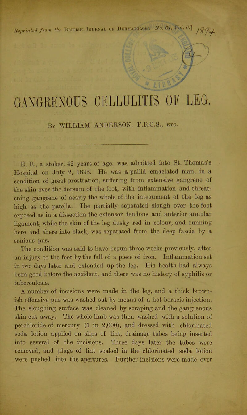 Reprinted from the British Journal ok Dkumatolooy No. G4, Vol. 0.] 1*9+. GANGRENOUS CELLULITIS OF LEG. By WILLIAM ANDERSON, F.R.C.S., etc. E. B., a stoker, 42 years of age, was admitted into St. Thomas's Hospital on July 2, 1893. He was a pallid emaciated man, in a condition of great prostration, suffering from extensive gangrene of the skin over the dorsum of the foot, with inflammation and threat- ening gangrene of nearly the whole of the integument of the leg as high as the patella. The partially separated slough over the foot exposed as in a dissection the extensor tendons and anterior annular ligament, while the skin of the leg dusky red in colour, and running here and there into black, was separated from the deep fascia by a sanious pus. The condition was said to have begun three weeks previously, after an injury to the foot by the fall of a piece of iron. Inflammation set in two days later and extended up the leg. His health had always been good before the accident, and there was no history of syphilis or tuberculosis. A number of incisions were made in the leg, and a thick brown- ish offensive pus was washed out by means of a hot boracic injection. The sloughing surface was cleaned by scraping and the gangrenous skin cut away. The whole limb was then washed with a solution of perchloride of mercury (1 in 2,000), and dressed with chlorinated soda lotion applied on slips of lint, drainage tubes being inserted into several of the incisions. Three days later the tubes were removed, and plugs of lint soaked in the chlorinated soda lotion were pushed into the apertures. Further incisions were made over