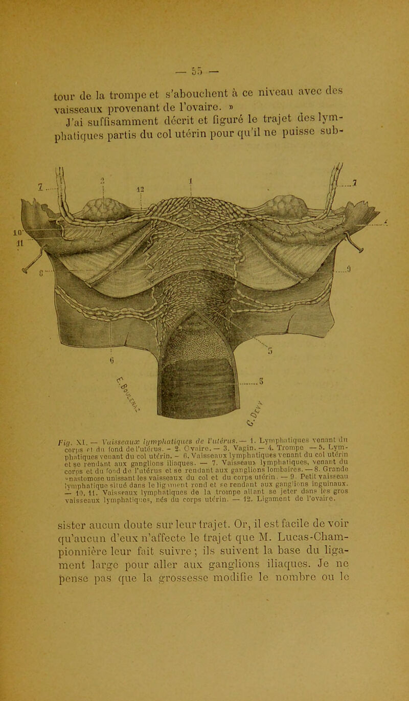 tour tie la trompe et s’abouchent a ce niveau avec des vaisseaux provenant tie l’ovaire. » j’ai suffisamment ddcrit et figure le trajet des lym- phatiques partis du col uterin pour qu’il ne puisse sub- fin. X[.— Vaisseaux lymphatiques do I'uterus.— 1. Lymphaliques vonnnt tin corps cl (In (ond do I’utdrus. - 2. Cvnirc.— 3. Vagin. — A. Trompo —5. Lym- phntiques venant du col utt'rin. - fi. Vaisseaux lympliatiques venant du col uterin ct so rendant aux ganglions ilinques. — 7. Vaisseaux lymphatiques, venant du corns ct du fond do I’utdrus ot so rendant aux ganglions lombalrcs.— 8. Grande anastomose unissant les vaisseaux du col ct du corps uterin. — 9 Petit vaisseau Ivinphatiquo silud dans leligunent ronil et so rendant aux ganglions inguinaux. — 10, 11. Vaisseaux lymphatiques do la trompe allant se jetor dans les gros vaisseaux lymphatiques, mis du corps uterin. — 12. Ligament do l’ovaire. sister aucun cloute sur leur trajet. Or, il est facile de voir qu’aucun d’eux n’affccte lc trajet que M. Lucas-Cham- pionnierc leur fait suivre; ils suivent la base du liga- ment large pour aller aux ganglions iliaques. Je no pensc pas que la grossesse motlifie le nombre ou le