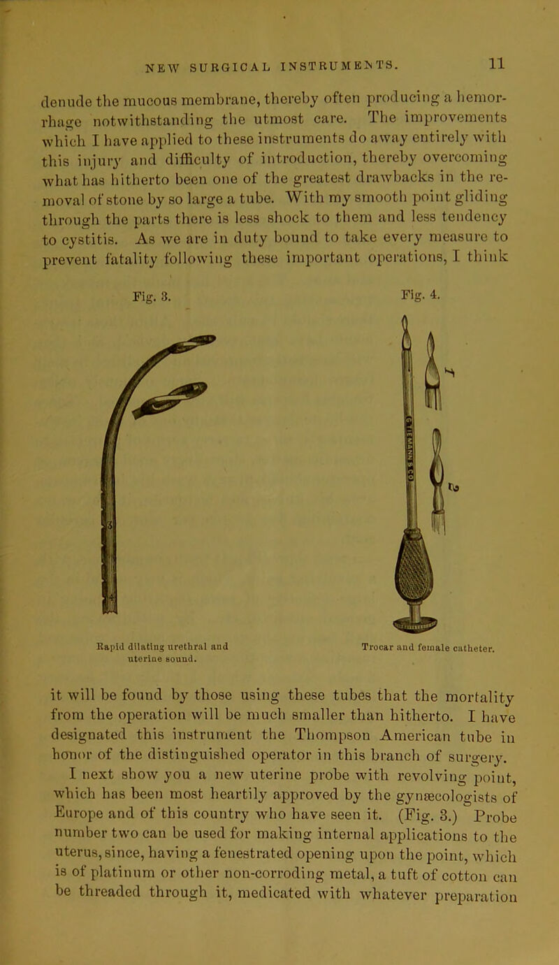 denude the mucous membrane, thereby often producing a hemor- rhage notwithstanding the utmost care. The improvements which I have applied to these instruments do away entirely with this injury and difficulty of introduction, thereby overcoming what has hitherto been one of the greatest drawbacks in the re- moval of stone by so large a tube. With my smooth point gliding through the parts there is less shock to them and less tendency to cystitis. As we are in duty bound to take every measure to prevent fatality following these important operations, I think it will be found by those using these tubes that the mortality from the operation will be much smaller than hitherto. I have designated this instrument the Thompson American tube in honor of the distinguished operator in this branch of surgery. I next show you a new uterine probe with revolving point, which has been most heartily approved by the gynaecologists of Europe and of this country who have seen it. (Fig. 3.) Probe number two can be used for making internal applications to the uterus,since, having a fenestrated opening upon the point, which is of platinum or other non-corroding metal, a tuft of cotton can be threaded through it, medicated with whatever preparation Fig. 3. Fig. 4. Kapid dilating urethral and uterine sound. Trocar and female catheter.