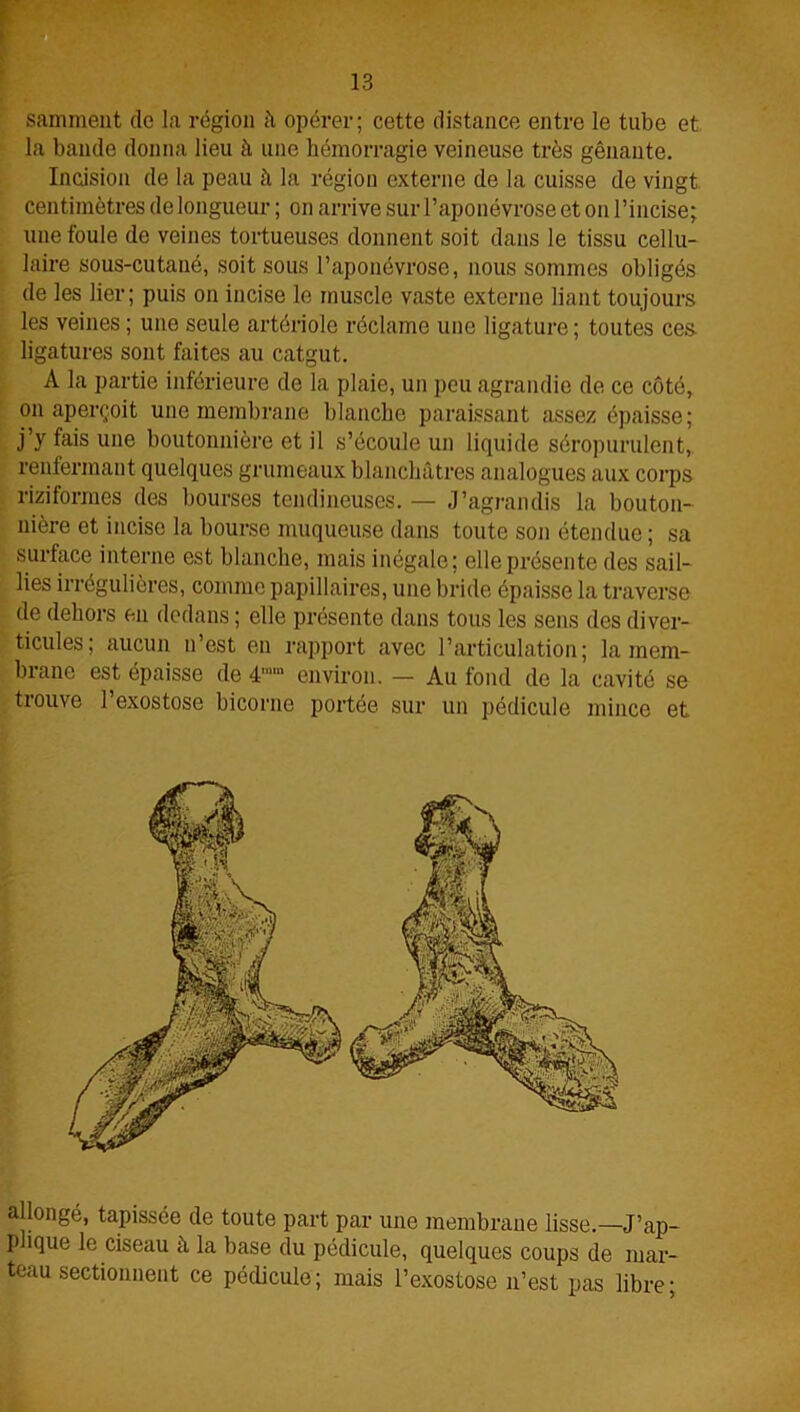 sammeut de la région à opérer; cette distance entre le tube et la bande donna lieu à une hémorragie veineuse très gênante. Incision de la peau à la région externe de la cuisse do vingt centimètres de longueur ; on arrive sur l’aponévrose et on l’incise; une foule de veines tortueuses donnent soit dans le tissu cellu- laire sous-cutané, soit sous l’aponévrose, nous sommes obligés de les lier; puis on incise le muscle vaste externe liant toujours les veines; une seule artériole réclame une ligature; toutes ces ligatures sont faites au catgut. !A la partie inférieure de la plaie, un peu agrandie de ce côté, on aperçoit une membrane blanche paraissant assez épaisse; j y fais une boutonnière et il s’écoule un liquide séropurulent, renfermant quelques grumeaux blanchâtres analogues aux corps riziformes des bourses tendineuses. — J’agrandis la bouton- nière et incise la bourse muqueuse dans toute son étendue ; sa surface interne est blanche, mais inégale; elle présente des sail- lies irrégulières, comme papillaires, une bride épaisse la traverse de dehors en dedans ; elle présente dans tous les sens des diver- ticules; aucun n’est en rapport avec l’articulation; la mem- brane est épaisse de 4 environ. — Au fond de la cavité se trouve l’exostose bicorne portée sur un pédicule mince et allongé, tapissée de toute part par une membrane lisse.—J’ap- plique le ciseau à la base du pédicule, quelques coups de mar- teau sectionnent ce pédicule; mais l’exostose n’est pas libre;
