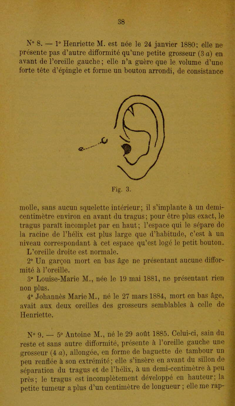N° 8. — 1° Henriette M. est née le 24 janvier 1880; elle ne présente pas d’autre difformité qu’une petite grosseur (3 a) en avant de l’oreille gauche ; elle n’a guère que le volume d’une forte tête d’épingle et forme un bouton arrondi, de consistance molle, sans aucun squelette intérieur; il s’implante à un demi- centimètre environ en avant du tragus; pour être plus exact, le tragus paraît incomplet par en haut ; l’espace qui le sépare de la racine de l’hélix est plus large que d’habitude, c’est à un niveau correspondant à cet espace qu’est logé le petit bouton. L’oreille droite est normale. 2° Un garçon mort en bas âge ne présentant aucune diffor- mité à l’oreille. 3° Louise-Marie M., née le 19 mai 1881, ne présentant rien non plus. 4° Johannès Marie M., né le 27 mars 1884, mort en bas âge, avait aux deux oreilles des grosseurs semblables à celle de Henriette. N° 9. _ 5° Antoine M., né le 29 août 1885. Celui-ci, sain du reste et sans autre difformité, présente à l’oreille gauche une grosseur (4 a), allongée, en forme de baguette de tambour un peu renflée à son extrémité; elle s’insère en avant du sillon de séparation du tragus et de l’hélix, à un demi-centimètre à peu près ; le tragus est incomplètement développé en hauteur ; la petite tumeur a plus d’un centimètre de longueur ; elle me rap-