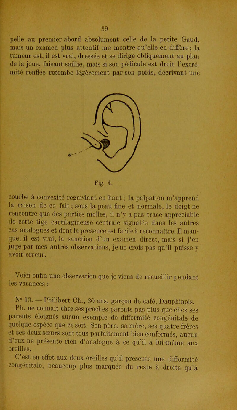 pelle au premier abord absolument celle de la petite Gaud, mais un examen plus attentif me montre qu’elle en diffère ; la tumeur est, il est vrai, dressée et se dirige obliquement au plan de la joue, faisant saillie, mais si son pédicule est droit l’extré- mité renflée retombe légèrement par son poids, décrivant une courbe à convexité regardant en haut; la palpation m’apprend la raison de ce fait ; sous la peau fine et normale, le doigt ne rencontre que des parties molles, il n’y a pas trace appréciable de cette tige cartilagineuse centrale signalée dans les autres cas analogues et dont la présence est facile à reconnaître. Il man- que, il est vrai, la sanction d’un examen direct, mais si j’en juge par mes autres observations, je ne crois pas qu’il puisse y avoir erreur. Voici enfin une observation que je viens de recueillir pendant les vacances : N° 10. —Philibert Ch., 30 ans, garçon de café, Dauphinois. Ph. ne connaît chez ses proches parents pas plus que chez ses parents éloignés aucun exemple de difformité congénitale de quelque espèce que ce soit. Son père, sa mère, ses quatre frères et ses deux sœurs sont tous parfaitement bien conformés, aucun d’eux ne présente rien d’analogue à ce qu’il a lui-même aux oreilles. C’est en effet aux deux oreilles qu’il présente une difformité congénitale, beaucoup plus marquée du reste à droite qu’à Fig. 4.