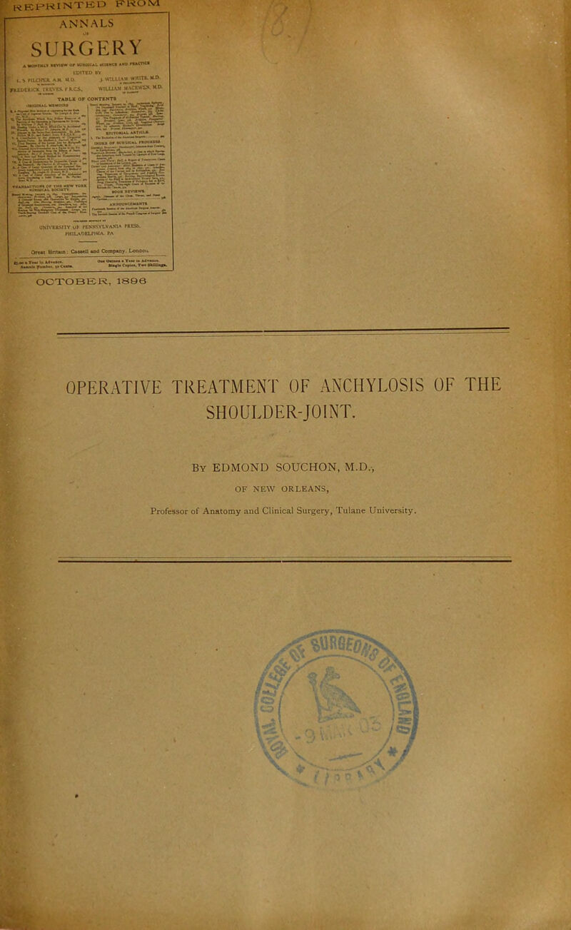 f KEHRINTED EROrvl annals SURGERY AWQKTtU.V MVI*** Of tUaOKAL KUNCB *«» fBACnC* borreo BY t. S riLCHgK. A.M. U O. > WtLUAM >HEDE1UCX rft^ES.fR.CS, WILLIAM MACBWS.N. MR TABLS or CONTENTS OBIOIMAl. MBWOUU tECKTA'rtLir'-i.r::-. KPITOMAL ARTtCUl L iw»»«■■« (HDU 0? •0»»IC*L f»P0««*B ■0«K atVIKWt ONIY'ESSJTY OF PENNSYLVANIA PRESS. PHtLAOELPlilA PA Omt Bntun: «q4 Coiapany. London. OCXOBER, 18Q6 a OPERATIVE TREATMENT OF ANCHYLOSIS OF THE SHOULDER-JOINT. By EDMOND SOUCHON, M.D.-, OF NEW ORLEANS, Professor of Anatomy and Clinical Surgery, Tulane University.