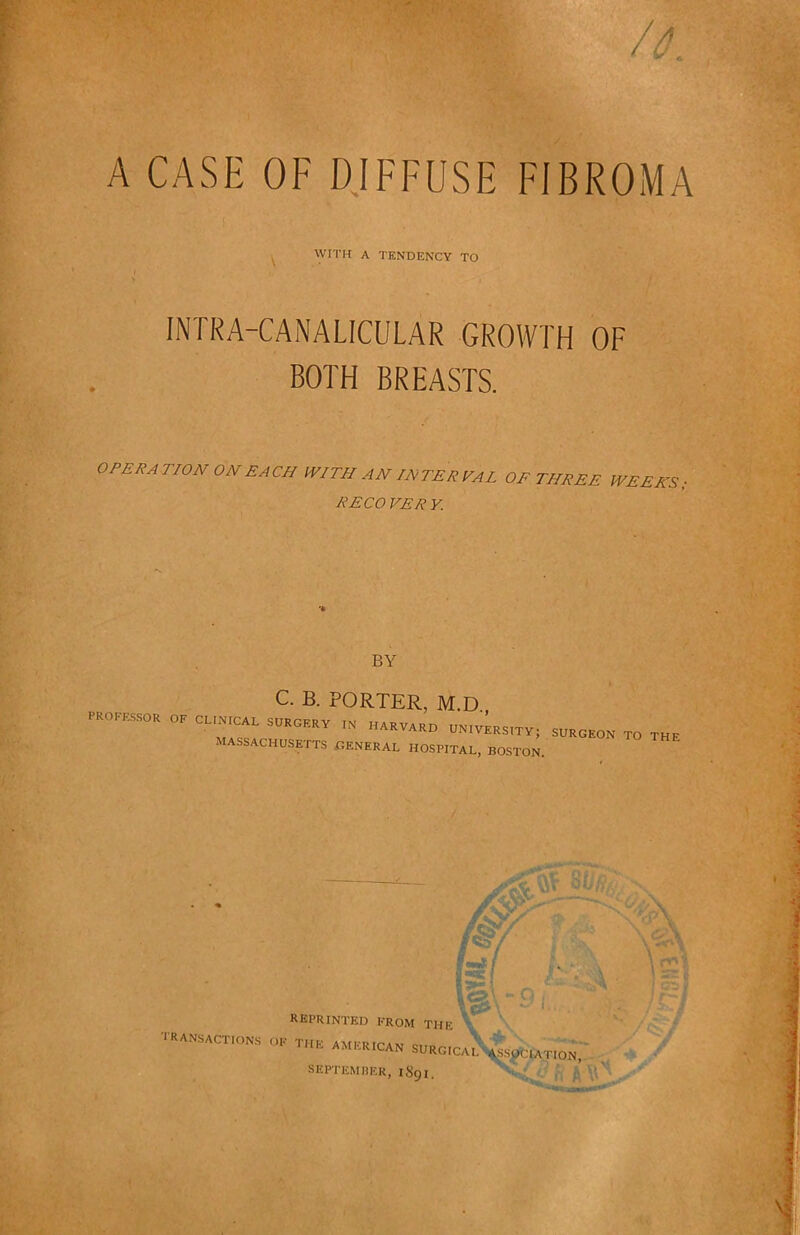 A CASE OF DIFFUSE FIBROMA ^ WITH A TENDENCY TO INTKA-CANALICULAR GROWTH OF BOTH BREASTS. OPERA TION ON EACH WITH AN INTER PAL OF THREE WEEKS , RECO VER K BY C. B. PORTER, M.D., PROKES.SOR OF CLINICAL SURGERY IN HARVARD UNIVERSITY; SURGEON TO THE ASSACHUSETTS .general HOSPITAL, BOSTON. . V- reprinted from the V -ANSACTIONS of the AMERICAN SURg;c.JS^s^iatION.- SEPTEMHER, 1891, '• .