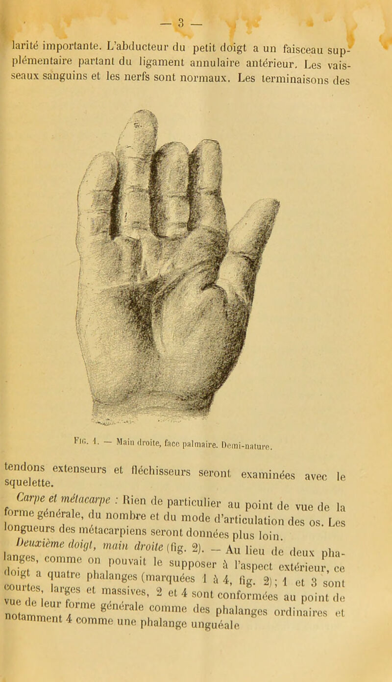 larité importante. L’abducteur du petit doigt a un faisceau sup- plémentaire partant du ligament annulaire antérieur. Les vais- seaux sanguins et les nerfs sont normaux. Les terminaisons des l'in. -1. Main droite, face palmaire. Demi-nature. tendons extenseurs et lléchisseurs seront examinées avec le squelette. Carpe elmét,mn,e : liien de particulier au point de vue de la orme générale, du nombre et du mode d'articulation des os. Les longueurs des métacarpiens seront données plus loin Deuxième doigt, main droite (üg. 2). - Au lieu de deux pha- doSVoTr T supposer à l’aspect extérieur, ce 01g a quatre phalanges (marquées 1 à 4, fig. 2) • 1 et 3 sont rur rie T “ ' “^“‘confoLéls au polnute notamment i ® PI'‘‘'»S50S ordinaires et notamment 4 comme une phalange unguéale