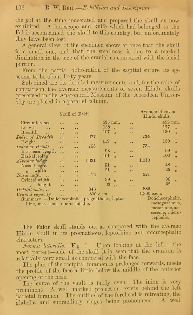the jail at the time, macerated and prepared the skull as now exhibited. A horoscope and knife which had belonged to the Fakir accompanied the skull to tliis country, but unfortunately they have been lost. A general view of the specimen shows at once that the skull is a small one, and that the smallness is due to a marked diminution in the size of the cranial as compared with the facial portion. From the partial obliteration of the sagittal suture its age seems to be about forty years. Subjoined are its detailed measurements and, for the sake of comparison, the average measurements of seven Hindu skulls preserved in the Anatomical Museum of the Aberdeen Univer- sity are placed in a parallel column. Skull of Fakir. Cii'cumference Length Breadth Index of Breadth Height Index of Height Basi-nasal length Basi-alveolaj»^ Alveolar ind^ Nasal heimt „ wMth Nasal index .. Orbital width _ » height Orbital index .. Cranial capacity Summary :—Dolichocephalic, prognatlious, leptor- hine, mesoseme, microcephalic. Average of seven Hindu skulls. 435 mm. 492 158 )> 177 107 )) 130 677 734 119 >i 130 753 734 98 yt 99 101 yy 100 1,031 1,010 51 yy 48 21 yy 25 412 521 39 yy 36 33 yy 32 846 889 800 c.cm. 1,300 c.cm. Dohchocephahc, mesognathous, mesorhine, me- soseme, micro- cephalic. The Fakir skull stands out as compared with the average Hindu skull in its prognathous, leptorhine and microcephalic characters. Norma lateralis.—Fig. 1. Upon looking at the left — the most j)erfect—side of the skull it is seen that the cranium is relatively very small as compared with the face. The plan of the occipital foramen is prolonged forwards, meets the profile of tlie face a little below the middle of the anterior opening of the nose. The curve of the vault is fairly even. ^ The iuion is very prominent. A well marked projection exists behind the left ])arietal foi'camen. The outline of the iorehejid is letieating, the glabella and siipraciliary ridges being pronounced. A well