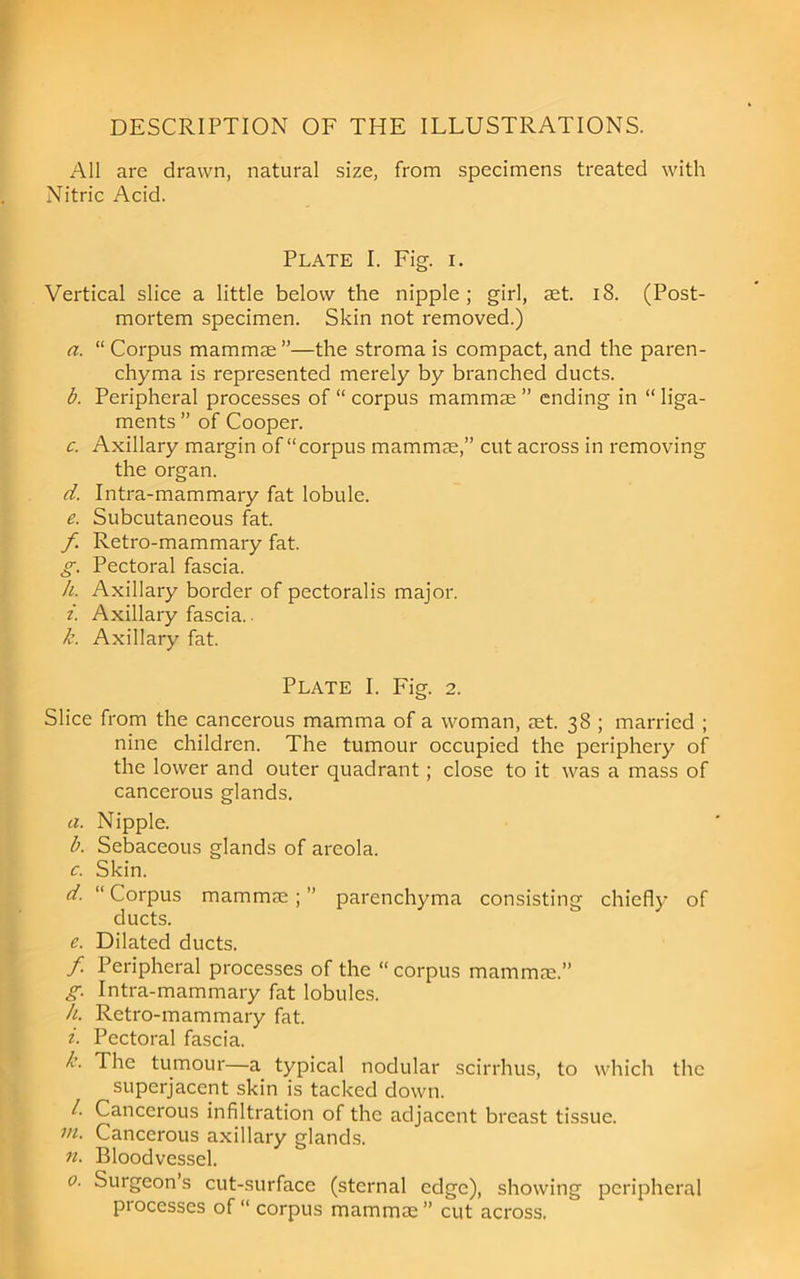 DESCRIPTION OF THE ILLUSTRATIONS. All are drawn, natural size, from specimens treated with Nitric Acid. Plate I. Fig. i. Vertical slice a little below the nipple; girl, set. i8. (Post- mortem specimen. Skin not removed.) a. “ Corpus mammae ”—the stroma is compact, and the paren- chyma is represented merely by branched ducts. <5. Peripheral processes of “ corpus mammae ” ending in “ liga- ments ” of Cooper. c Axillary margin of “corpus mammae,” cut across in removing the organ. d Intra-mammary fat lobule. e. Subcutaneous fat. /. Retro-mammary fat. £■. Pectoral fascia. A. Axillary border of pectoralis major. z'. Axillary fascia.. A Axillary fat. Plate I. Fig. 2. Slice from the cancerous mamma of a woman, aet. 38 ; married ; nine children. The tumour occupied the periphery of the lower and outer quadrant; close to it was a mass of cancerous glands. a. Nipple. A. Sebaceous glands of areola. c. Skin. d. “ Corpus mammae; ” parenchyma consisting chiefly of ducts. e. Dilated ducts. / Peripheral processes of the corpus mammae.” £■. Intra-mammary fat lobules. h. Retro-mammary fat. z. Pectoral fascia. k. The tumour—a typical nodular scirrhus, to which the superjacent skin is tacked down. l. Cancerous infiltration of the adjacent breast tissue. VI. Cancerous axillary glands. n. Bloodvessel. 0. Surgeon’s cut-surface (sternal edge), showing peripheral processes of corpus mammae” cut across.
