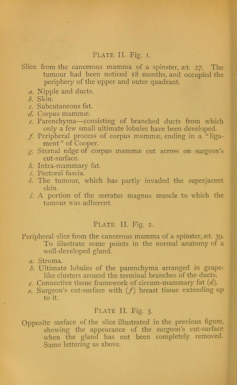 Plate II. Fig. i. Slice from the cancerous mamma of a spinster, set. 27. The tumour had been noticed 18 months, and occupied the periphery of the upper and outer quadrant. a. Nipple and ducts. b. Skin. c. Subcutaneous fat. d. Corpus mammae. e. Parenchyma—consisting of branched ducts from which only a few small ultimate lobules have been developed. f. Peripheral process of corpus mammae, ending in a “ liga- ment ” of Cooper. g. Sternal edge of corpus mammae cut across on surgeon’s cut-surface. h. Intra-mammary fat. i. Pectoral fascia. k. The tumour, which has partly invaded the superjacent skin. /. A portion of the serratus magnus muscle to which the tumour was adherent. Plate. II. Fig. 2. Peripheral slice from the cancerous mamma of a spinster, aet. 39. To illustrate some points in the normal anatomy of a well-developed gland. a. Stroma. b. Ultimate lobules of the parenchyma arranged in grape- like clusters around the terminal branches of the ducts. c. Connective tissue framework of circum-mammary fat id). e. Surgeon’s cut-surface with {f) breast tissue extending up to it. Plate II. Fig. 3. Opposite surface of the slice illustrated in the previous figure, showing the appearance of the surgeon’s cut-surface when the gland has not been completely removed. Same lettering as above.