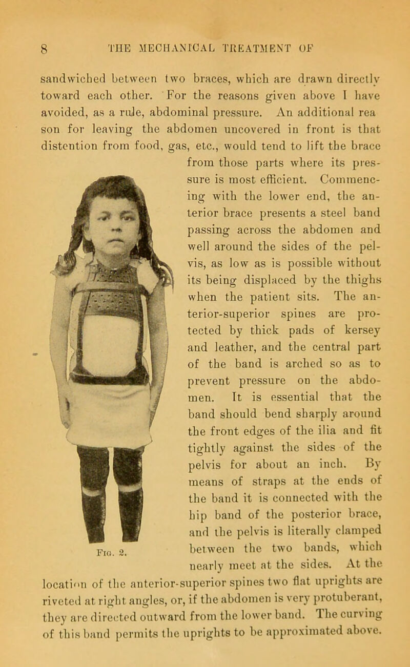 sandwiched between two braces, wbicli are drawn directly toward eacli other. For the reasons given above 1 have avoided, as a rule, abdominal pressure. An additional rea son for leaving the abdomen uncovered in front is that distention from food, gas, etc., would tend to lift the brace from those parts where its pres- sure is most efficient. Commenc- ing with the lower end, the an- terior brace presents a steel band passing across the abdomen and well around the sides of the pel- vis, as low as is possible without its being displaced by the thighs when the patient sits. The an- terior-superior spines are pro- tected by thick pads of kersey and leather, and the central part of the band is arched so as to prevent pressure on the abdo- men. It is essential that the band should bend sharply around the front edges of the ilia and fit tightly against the sides of the pelvis for about an inch. By means of straps at the ends of the band it is connected with the hip band of the posterior brace, and the pelvis is literally clamped between the two bands, which nearly meet at the sides. At the location of the anterior-superior spines two flat uprights are riveted at right angles, or, if the abdomen is very protuberant, they ai'e directed outward from the lower band. The curving of this band permits the uprights to be approximated above.