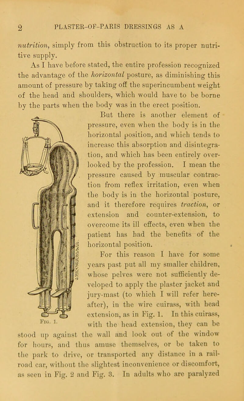 nutrition, simply from this obstruction to its proper nutri- tive supply. As I have before stated, the entire profession recognized the advantage of the horizontal posture, as diminishing this amount of pressure by taking off the superincumbent weight of the head and shoulders, which would have to be borne by the parts when the body was in the erect position. But there is another element of pressure, even when the body is in the horizontal position, and which tends to increase this absorption and disintegra- tion, and which has been entirely over- looked by the profession. I mean the pressure caused by muscular contrac- tion from reflex irritation, even when the body is in the horizontal posture, and it therefore requires traction, or extension and counter-extension, to overcome its ill effects, even when the patient has had the benefits of the horizontal position. For this reason 1 have for some years past put all my smaller children, whose pelves were not sufficiently de- veloped to apply the plaster jacket and jury-mast (to which I will refer here- after), in the wire cuirass, with head extension, as in Fig. 1. In this cuirass, with the head extension, they can be stood up against the wall and look out of the window for hours, and thus amuse themselves, or be taken to the park to drive, or transported any distance in a rail- road car, without the slightest inconvenience or discomfort, as seen in Fig. 2 and Fig. 3. In adults who are paralyzed