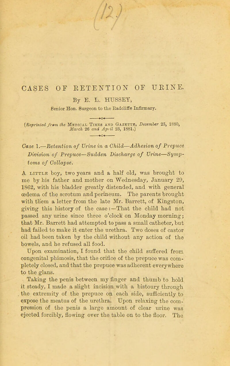 CASES OF RETENTION OE URINE. By E. L. HUSSEY, Senior Hon. Surgeon to tire Radcliffe Infirmary. {Reprinted fr»m the Medical Times and Gazette, December 25, 1880, March 26 and Apiil 23, 1881.) C«se 1.—Retention of Urine in a Child—Adhesion of Prepuce Division of Prepuce—Sudden Discharge of Urine—Symp- toms of Collapse. A little boy, two years and a balf old, was brought to me by bis father and mother on Wednesday, January 29, 1862, with his bladder greatly distended, and with general oedema of the scrotum and perineum. The parents brought with them a letter from the late Mr. Barrett, of Kingston, giving this history of the case:—That the child had not passed any urine since three o’clock on Monday morning; that Mr. Barrett had attempted to pass a small catheter, but had failed to make it enter the urethra. Two doses of castor oil had been taken by the child without any action of the bowels, and he refused all food. Upon examination, I found that the child suffered from congenital phimosis, that the orifice of the prepuce was com- pletely closed, and that the prepuce was adherent everywhere to the glans. Taking the penis between my finger and thumb to hold it steady, I made a slight incision with a bistoury through the extremity of the prepuce on each side, sufficiently to expose the meatus of the urethra. Upon relaxing the com- pression of the penis a largo amount of clear urine was ejected forcibly, flowing over the table on to the floor. The