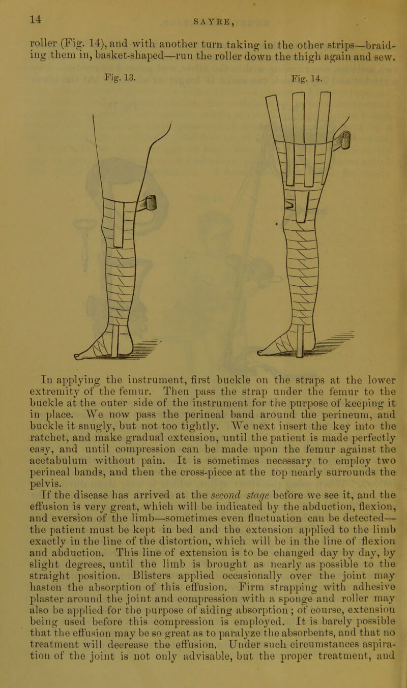 roller (Fig. 14), and with another turn taking in the other strips—braid- ing them in, basket-shaped—run the roller down the thigh again and sew. In applying the instrument, first buckle on the straps at the lower extremity of the femur. Then pass the strap under the femur to the buckle at the outer side of the instrument for the purpose of keeping it in place. We now pass the perineal band around the perineum, and buckle it snugly, but not too tightly. We next insert the key into the ratchet, and make gradual extension, until the patient is made perfectly easy, and until compression can be made upon the femur against the acetabulum without pain. It is sometimes necessary to employ two perineal bands, and then the cross-piece at the top nearly surrounds the pelvis. If the disease has arrived at the second stage before we see it, and the effusion is very great, which will be indicated by the abduction, flexion, and eversion of the limb—sometimes even fluctuation can be detected— the patient must be kept in bed and the extension applied to the limb exactly in the line of the distortion, which will be in the line of flexion and abduction. This line of extension is to be changed day by day, by slight degrees, until the limb is brought as nearly as possible to the straight position. Blisters applied occasionally over the joint may hasten the absorption of this effusion. Firm strapping with adhesive plaster around the joint and compression with a sponge and roller may also be applied for the purpose of aiding absorption ; of course, extension being used before this compression is employed. It is barely possible that the effusion may be so great as to paralyze the absorbents, and that no treatment will decrease the effusion. Under such circumstances aspira- tion of the joint is not only advisable, but the proper treatment, and