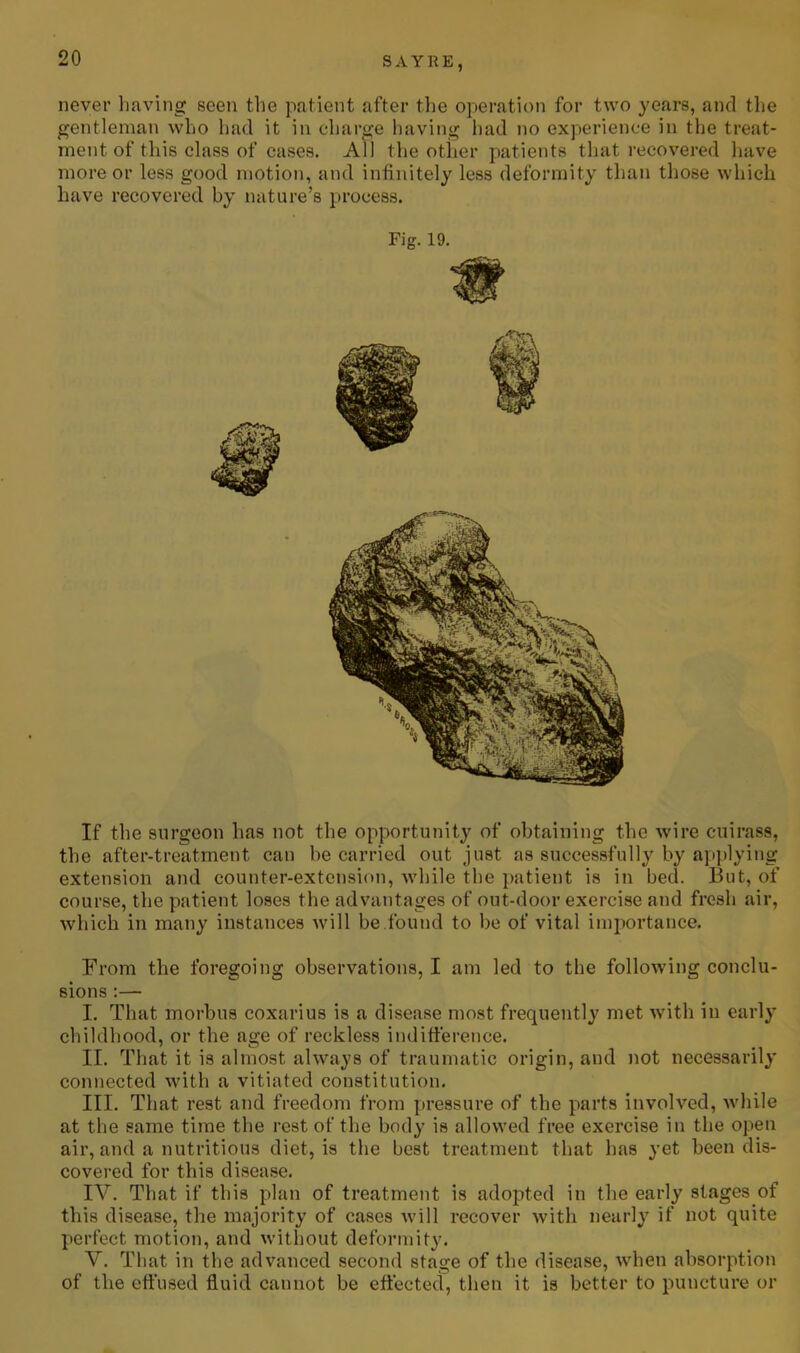 never having seen the patient after the operation for two years, and the gentleman who had it in charge having had no experience in the treat- ment of tins class of cases. All the other patients that recovered have more or less good motion, and infinitely less deformity than those which have recovered by nature’s process. Fig. 19. If the surgeon has not the opportunity of obtaining the wire cuirass, the after-treatment can be carried out just as successfully by applying extension and counter-extension, while the patient is in bed. But, of course, the patient loses the advantages of out-door exercise and fresh air, which in many instances will be found to be of vital importance. From the foregoing observations, I am led to the following conclu- sions :— I. That morbus coxarius is a disease most frequently met with in early childhood, or the age of reckless indifference. II. That it is almost always of traumatic origin, and not necessarily connected with a vitiated constitution. III. That rest and freedom from pressure of the parts involved, while at the same time the rest of the body is allowed free exercise in the open air, and a nutritious diet, is the best treatment that has yet been dis- covered for this disease. IV. That if this plan of treatment is adopted in the early stages.of this disease, the majority of eases will recover with nearly if not quite perfect motion, and without deformity. V. That in the advanced second stage of the disease, when absorption of the effused fluid cannot be effected, then it is better to puncture or