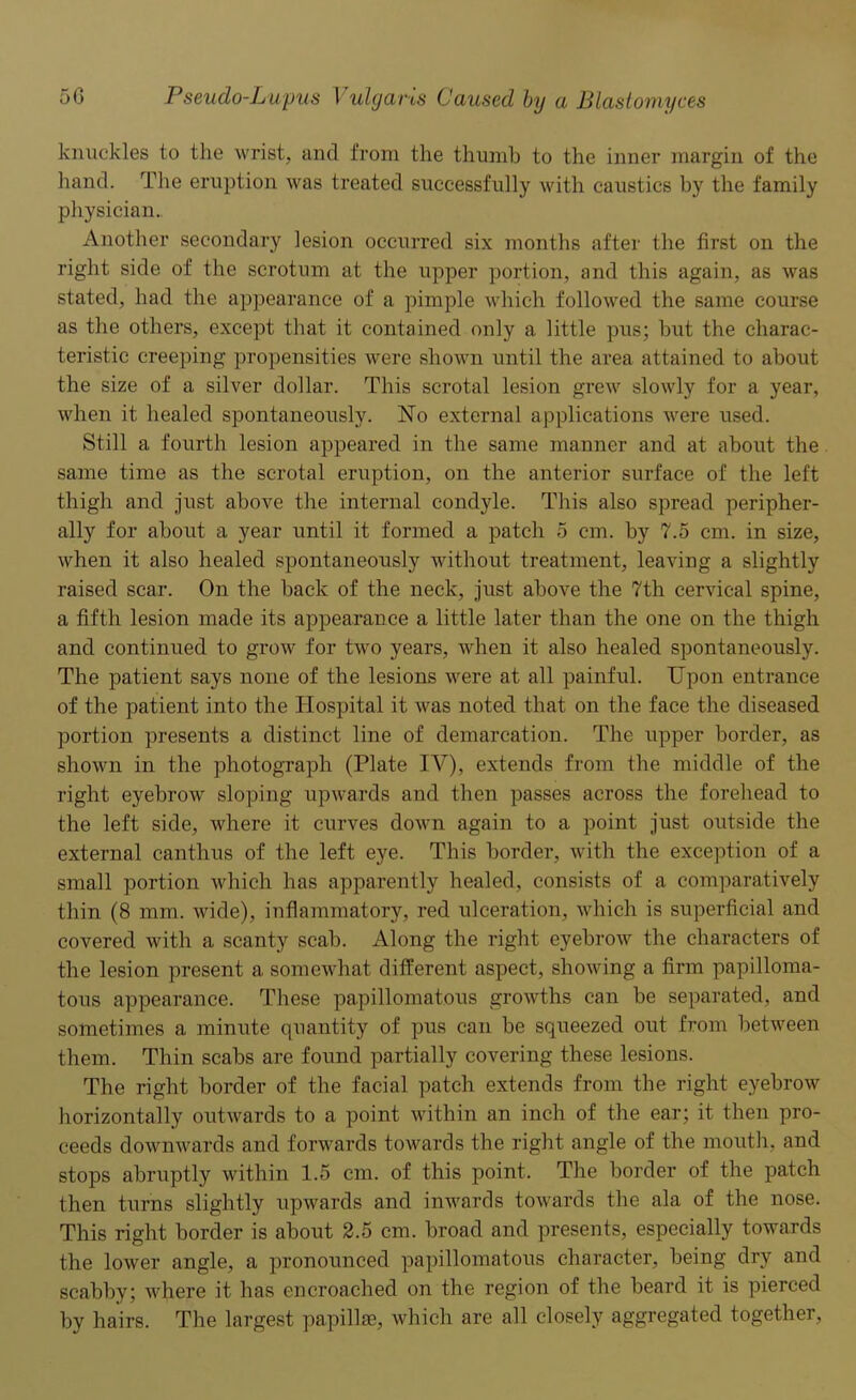 knuckles to the wrist, and from the thumb to the inner margin of the hand. The eruption was treated successfully with caustics by the family physician. Another secondary lesion occurred six months after the first on the right side of the scrotum at the upper portion, and this again, as was stated, had the appearance of a pimple which followed the same course as the others, except that it contained only a little pus; but the charac- teristic creeping propensities were shown until the area attained to about the size of a silver dollar. This scrotal lesion grew slowly for a year, when it healed spontaneously. No external applications were used. Still a fourth lesion appeared in the same manner and at about the same time as the scrotal eruption, on the anterior surface of the left thigh and just above the internal condyle. This also spread peripher- ally for about a year until it formed a patch 5 cm. by 7.5 cm. in size, when it also healed spontaneously without treatment, leaving a slightly raised scar. On the hack of the neck, just above the 7th cervical spine, a fifth lesion made its appearance a little later than the one on the thigh and continued to grow for two years, when it also healed spontaneously. The patient says none of the lesions were at all painful. Upon entrance of the patient into the Hospital it was noted that on the face the diseased portion presents a distinct line of demarcation. The upper border, as shown in the photograph (Plate IV), extends from the middle of the right eyebrow sloping upwards and then passes across the forehead to the left side, where it curves down again to a point just outside the external canthus of the left eye. This border, with the exception of a small portion which has apparently healed, consists of a comparatively thin (8 mm. wide), inflammatory, red ulceration, which is superficial and covered with a scanty scab. Along the right eyebrow the characters of the lesion present a somewhat different aspect, showing a firm papilloma- tous appearance. These papillomatous growths can he separated, and sometimes a minute quantity of pus can be squeezed out from between them. Thin scabs are found partially covering these lesions. The right border of the facial patch extends from the right eyebrow horizontally outwards to a point within an inch of the ear; it then pro- ceeds downwards and forwards towards the right angle of the mouth, and stops abruptly within 1.5 cm. of this point. The border of the patch then turns slightly upwards and inwards towards the ala of the nose. This right border is about 2.5 cm. broad and presents, especially towards the lower angle, a pronounced papillomatous character, being dry and scabby; where it has encroached on the region of the heard it is pierced by hairs. The largest papillae, which are all closely aggregated together,