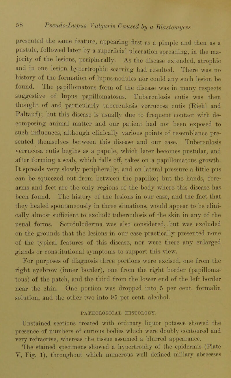 presented the same feature, appearing first as a pimple and then as a pustule, followed later by a superficial ulceration spreading, in the ma- jority of the lesions, peripherally. As the disease extended, atrophic and in one lesion hypertrophic scarring had resulted. There was no history of the formation of lupus-nodules nor could any such lesion be found. The papillomatous form of the disease was in many respects suggestive of lupus papillomatoses. Tuberculosis cutis was then thought of and particularly tuberculosis verrucosa cutis (Riehl and Paltauf); but this disease is usually due to frequent contact with de- composing animal matter and our patient had not been exposed to such influences, although clinically various points of resemblance pre- sented themselves between this disease and our case. Tuberculosis verrucosa cutis begins as a papule, which later becomes pustular, and after forming a scab, which falls off, takes on a papillomatous growth. It spreads very slowly peripherally, and on lateral pressure a little pus can be squeezed out from between the papillae; but the hands, fore- arms and feet are the only regions of the body where this disease has been found. The history of the lesions in our case, and the fact that they healed spontaneously in three situations, would appear to be clini- cally almost sufficient to exclude tuberculosis of the skin in any of the usual forms. Scrofuloderma was also considered, but was excluded on the grounds that the lesions in our case practically presented none of the typical features of this disease, nor were there any enlarged glands or constitutional symptoms to support this view. For purposes of diagnosis three portions were excised, one from the right eyebrow (inner border), one from the right border (papilloma- tous) of the patch, and the third from the lower end of the left border near the chin. One portion was dropped into 5 per cent, formalin solution, and the other two into 95 per cent, alcohol. PATHOLOGICAL HISTOLOGY. Unstained sections treated with ordinary liquor potassse showed the presence of numbers of curious bodies which were doubly contoured and very refractive, whereas the tissue assumed a blurred appearance. The stained specimens showed a hypertrophy of the epidermis (Plate Y, Fig. 1), throughout which numerous well defined miliary abscesses