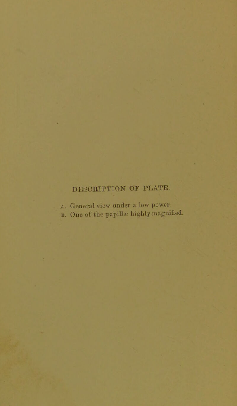 DESCRIPTION OF PLATE. A. General view under a low power. b. One of the papilla; highly magnified.