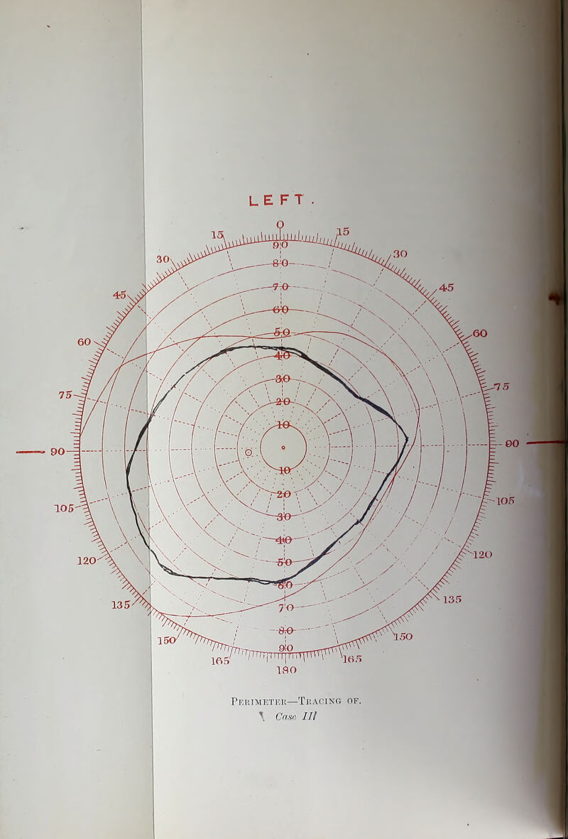 left. Perimetei!—TracinOx nr. \ Case, lit