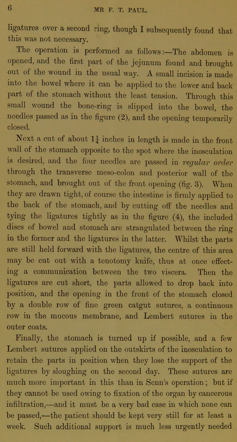 ligatures over a second ring, though I subsequently found that this was not necessary. The operation is performed as follows:—The abdomen is opened, and the first j^art of the jejunum found and brought out of the wound in the usual way. A small incision is made into the bowel where it can be applied to the lower and back part of the stomach without the least tension. Through this small wound the bone-ring is slipped into the bowel, the needles passed as in the figure (2), and the opening temporarily closed. Next a cut of about 1J inches in length is made in the front wall of the stomach opposite to the spot where the inosculation is desired, and the four needles are passed in regular order through the transverse meso-colon and posterior wall of the stomach, and brought out of the front opening (fig. 3). When they are drawn tight, of course the intestine is firmly applied to the back of the stomach, and by cutting off the needles and tying the ligatures tightly as in the figure (4), the included discs of bowel and stomach are strangulated between the ring in the former and the ligatures in the latter. Whilst the parts are still held forward with the ligatures, the centre of this area may be cut out with a tenotomy knife, thus at once effect- ing a communication between the two viscera. Then the ligatures are cut short, the parts allowed to drop back into position, and the opening in the front of the stomach closed by a double row of fine green catgut sutures, a continuous row in the mucous membrane, and Lembert sutures in the outer coats. Finally, the stomach is turned up if possible, and a few Lembert sutures applied on the outskirts of the inosculation to retain the parts in position when they lose the support of the ligatures by sloughing on the second day. These sutures are much more important in this than in Senn’s operation; but if they cannot be used owing to fixation of the organ by cancerous infiltration,—and it must be a very bad case in which none can be passed,—the patient should be kept very still for at least a week. Such additional support is much less urgently needed