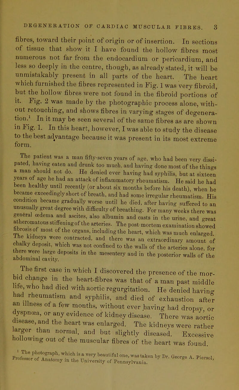 fibres, toward their point of origin or of insertion. In sections of tissue that show it I have found the hollow fibres niost numerous not far from the endocardium or pericardium, and less so deeply in the centre, though, as already stated, it will be unmistakably present in all parts of the heart. The heart which furnished the fibres represented in Fig. 1 was very fibroid, but the hollow fibres were not found in the fibroid portions of it. Fig. 2 was made by the photographic process alone, with- out retouching, and shows fibres in varying stages of degenera- tion.1 In it may be seen several of the same fibres as are shown in I ig. 1. In this heart, however, I was able to study the disease to the best advantage because it was present in its most extreme form. The patient was a man fifty-seven years of age, who had been very dissi- pated, having eaten and drunk too much, and having done most of the things a man should not do. He denied ever having had syphilis, but at sixteen years ol age he had an attack of inflammatory rheumatism. He said he had been healthy until recently (or about six months before his death), when he became exceedingly short of breath, and had some irregular rheumatism. His condition became gradually worse until he died, after having suffered to an unusually great degree with difficulty of breathing. For many weeks there was general oedema and ascites, also albumin and casts in the urine, and great atheromatous stiffening of the arteries. The post mortem examination showed nbrosisof most of the organs, including the heart, which was much enlarged lhe ktdneys were contracted, and there was an extraordinary amount of chalky deposit, which was not confined to the walls of the arteries alone, for there were large deposits in the mesentery and in the posterior walls of the abdominal cavity. The first case in which I discovered the presence of the mor- bid change in the heart-fibres was that of a man past middle life who had died with aortic regurgitation. He denied having- had rheumatism and syphilis, and died of exhaustion after an illness of a few months, without ever having had dropsy or dyspnoea, or any evidence of kidney disease. There was aortic disease, and the heart was enlarged. The kidneys were rather larger than normal, and but slightly diseased. Excessive hollowing out of the muscular fibres of the heart was found 1 The photograph, which is Professor of Anatomy in the a very beautiful one, was taken by Dr. George A. Piersol University of Pennsylvania.