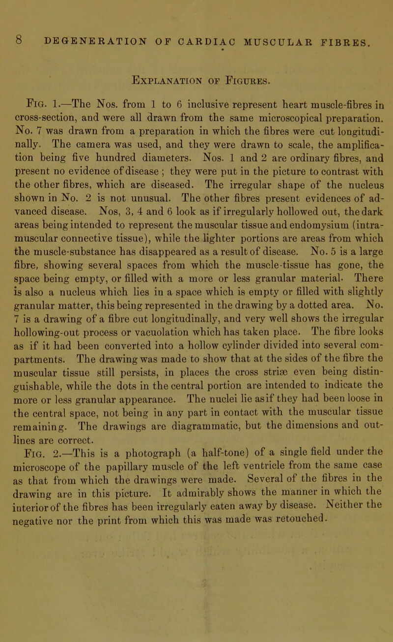 Explanation of Figures. Fig. 1.—The Nos. from 1 to 6 inclusive represent heart muscle-fibres in cross-section, and were all drawn from the same microscopical preparation. No. 7 was drawn from a preparation in which the fibres were cut longitudi- nally. The camera was used, and they were drawn to scale, the amplifica- tion being five hundred diameters. Nos. 1 and 2 are ordinary fibres, and present no evidence of disease ; they were put in the picture to contrast with the other fibres, which are diseased. The irregular shape of the nucleus shown in No. 2 is not unusual. The other fibres present evidences of ad- vanced disease. Nos, 3, 4 and 6 look as if irregularly hollowed out, the dark areas being intended to repi’esent the muscular tissue and endomysium (intra- muscular connective tissue), while the lighter portions are areas from which the muscle-substance has disappeared as a result of disease. No. 5 is a large fibre, showing several spaces from which the musole-tissue has gone, the space being empty, or filled with a more or less granular material. There is also a nucleus which lies in a space which is empty or filled with slightly granular matter, this being represented in the drawing by a dotted area. No. 7 is a drawing of a fibre cut longitudinally, and very well shows the irregular hollowing-out process or vacuolation which has taken place. The fibre looks as if it had been converted into a hollow cylinder divided into several com- partments. The drawing was made to show that at the sides of the fibre the muscular tissue still persists, in places the cross striae even being distin- guishable, while the dots in the central portion are intended to indicate the more or less granular appearance. The nuclei lie as if they had been loose in the central space, not being in any part in contact with the muscular tissue remaining. The drawings are diagrammatic, but the dimensions and out- lines are correct. Fig. 2.—This is a photograph (a half-tone) of a single field under the microscope of the papillary muscle of the left ventricle from the same case as that from which the drawings were made. Several of the fibres in the drawing are in this picture. It admirably shows the manner in which the interior of the fibres has been irregularly eaten away by disease. Neither the negative nor the print from which this was made was retouched.