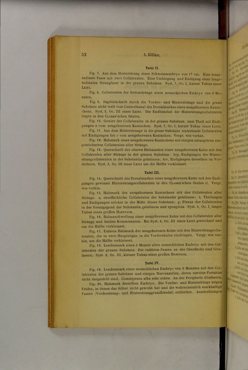 Tafel II. Fig. 7. Aus dem Hinterstrang eines Schweinsembryo von 17 cm. Eine longi- tudinale Faser mit zwei Collateralen. Eine Umbiegung und Endigung einer longi- tudinalen Strangfaser in der grauen Substanz. Syst. 7, Oc. 1, kurzer Tubus eines Leitz. Fig. 8. Collateralen der Seitenstränge eines menschlichen Embryo von 6 Mo- naten. Fig. 9. Sagittalschnitt durch die Vorder- und Hinterstränge und die graue Substanz nicht weit vom Centralkanal des Dorsalmarkes eines neugeborenen Kanin- chens. Syst. 3, Oc. 111 eines Leitz. Die Endbüschel der Hinterstrangcollateralen liegen in den CLARKE’schen Säulen. Fig. 10. Gewirr der Collateralen in der grauen Substanz, zum Theil mit Endi- gungen a vom neugeborenen Kaninchen. Syst. 7, Oc. I, kurzer Tubus eines Leitz. Fig. 11. Aus dem Hinterstrange in die graue Substanz eintretende Collateralen mit Endigungen bei c vom neugeborenen Kaninchen. Vergr. wie vorhin. FVg. 12. Halsmark eines neugeborenen Kaninchens mit einigen naturgetreu ein- gezeichneten Collateralen aller Stränge. Fig. 13. Querschnitt des oberen Halsmarkes einer neugeborenen Katze mit den Collateralen aller Stränge in der grauen Substanz, heg, Endigungen der Hinter- strangcollateralen in der Substantia gelatinosa; hev, Endigungen derselben im Vor- derhorn. Syst. 3, Oc. 111 eines Leitz um die Hälfte verkleinert. I , „ud» , . \'l)Ö w ,»#cl atz?1 i«W- P'J tboli^ ■tu Tafel in. Fig. 14. Querschnitt des Dorsalmarkes einer neugeborenen Katze mit den Endi- gungen gewisser Hinterstrangscollateralen in den CLARKE’schen Säulen cl. Vergr. wie vorhin. Fig. 15. Halsmark des neugeborenen Kaninchens mit den Collateralen aller Stränge, a, oberflächliche Collateralen der Substantia gelatinosa; t, Theilungen und Endigungen solcher in der Mitte dieser Substanz; g, Plexus der Collateralen in der Grenzgegend der Substantia gelatinosa und spongiosa. Syst. 4, Oc. I, langer Tubus eines großen Hartnack. Fig. 16. Halsanschwellung einer neugeborenen Katze mit den Collateralen aller Stränge und beiden Kommissuren. Bei Syst. 3, Oc. 111 eines Leitz gezeichnet und um die Hälfte verkleinert. Fig. 17. Unteres Halsmark der neugeborenen Katze mit den Hinterstrangcolla- teralen, die in zwei Hauptzügen in die Vordersäulen eindringen. Vergr. wie vor- hin, um die Hälfte verkleinert. Fig. 18. Lendenmark eines 5 Monate alten menschlichen Embryo mit den Col- lateralen der grauen Substanz. Die radiären Fasern an der Oberfläche sind Glia- fasern. Syst. 2, Oc. 111, kleiner Tubus eines großen Hartnack. Tafel IV. Fig. 19. Lendenmark eines menschlichen Embryo von 6 Monaten mit den Col- lateralen der grauen Substanz und einigen Nervenzellen, deren nervöse Fortsätze nicht dargestellt sind. Commissura alba sehr schön. An der Peripherie Gliafasern. F'ig. 20. Halsmark desselben Embryo. Die Vorder- und Hinterstränge zeigen Felder, in denen das Silber nicht gewirkt hat und die wahrscheinlich markhaltige Fasern (Vorderstrang- und Hinterstranggrundbündel) enthielten. Ausstrahlungen vor ft Tabus ein» Ui ft.a ,, Nerven^1 steilem V Fis. 15. Eine ebenso jjg.2, Querschnitl psuatiö.1 derCollatera weiße Sttbstani ist nirtit s Fis.iS.GliaÄoa kurzer Tubus eines Ltu fig. [29. Dorsale 1 Seliweinsembrvo von b irner, die nach verschi iill ein Zelle ail m, Substantia ^ inndc, Zflb ^meifentiii sträng mit j «ns den 'Reiften) f> Zelle s lern r Dervoset ,,teile a«sdem iefnlen,j ^cken. %![, r'Ssi