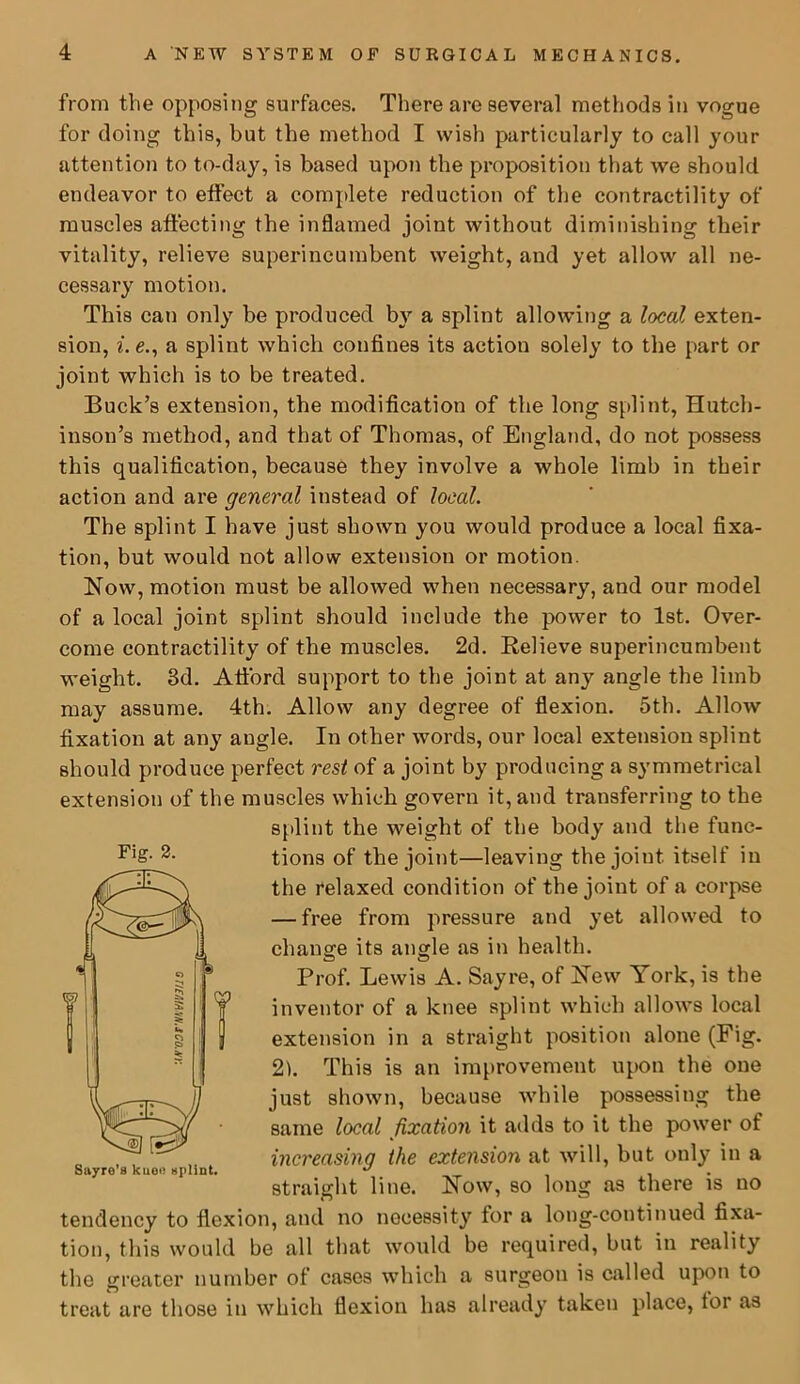 from the opposing surfaces. There are several methods in vogue for doing this, but the method I wish particularly to call your attention to to-day, is based upon the proposition that we should endeavor to effect a complete reduction of the contractility of muscles aftecting the inflamed joint without diminishing their vitality, relieve superincumbent weight, and yet allow all ne- cessary motion. This can only be produced by a splint allowing a local exten- sion, i. e., a splint which confines its action solely to the part or joint which is to be treated. Buck’s extension, the modification of the long splint, Hutch- inson’s method, and that of Thomas, of England, do not possess this qualification, because they involve a whole limb in their action and are general instead of local. The splint I have just shown you would produce a local fixa- tion, but would not allow extension or motion. Now, motion must be allowed when necessary, and our model of a local joint splint should include the power to 1st. Over- come contractility of the muscles. 2d. Relieve superincumbent weight. 3d. Alford support to the joint at any angle the limb may assume. 4th. Allow any degree of flexion. 5th. Allow fixation at any angle. In other words, our local extension splint should produce perfect rest of a joint by producing a symmetrical extension of the muscles which govern it, and transferring to the splint the weight of the body and the func- tions of the joint—leaving the joint itself in the relaxed condition of the joint of a corpse — free from pressure and yet allowed to change its angle as in health. Prof. Lewis A. Sayre, of New York, is the inventor of a knee splint which allows local extension in a straight position alone (Fig. 2). This is an improvement upon the one just shown, because while possessing the same local fixation it adds to it the power of increasing the extension at will, but only in a straight line. Now, so long as there is no tendency to flexion, and no necessity for a long-continued fixa- tion, this would be all that would be required, but in reality the greater number of cases which a surgeon is called upon to treat are those in which flexion has already taken place, tor as Fig. 2.