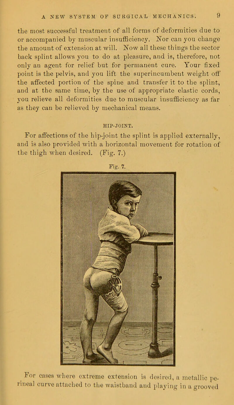 For cases wliere extreme extension is desired, a metallic pe- rineal curve attached to the waistband and playing in a grooved the most successful treatment of all forms of deformities due to or accompanied by muscular insufficiency. FTor can you change the amount of extension at will. Now all these things the sector back splint allows you to do at pleasure, and is, therefore, not only an agent for relief but for permanent cure. Your fixed point is the pelvis, and you lift the superincumbent weight otf the affected portion of the spine and transfer it to the splint, and at the same time, by the use of appropriate elastic cords, you relieve all deformities due to muscular insufficiency as far as they can be relieved by mechanical means. HIP-JOINT. For affections of the hip-joint the splint is applied externally, and is also provided with a horizontal movement for rotation of the thigh when desired. (Fig. 7.)