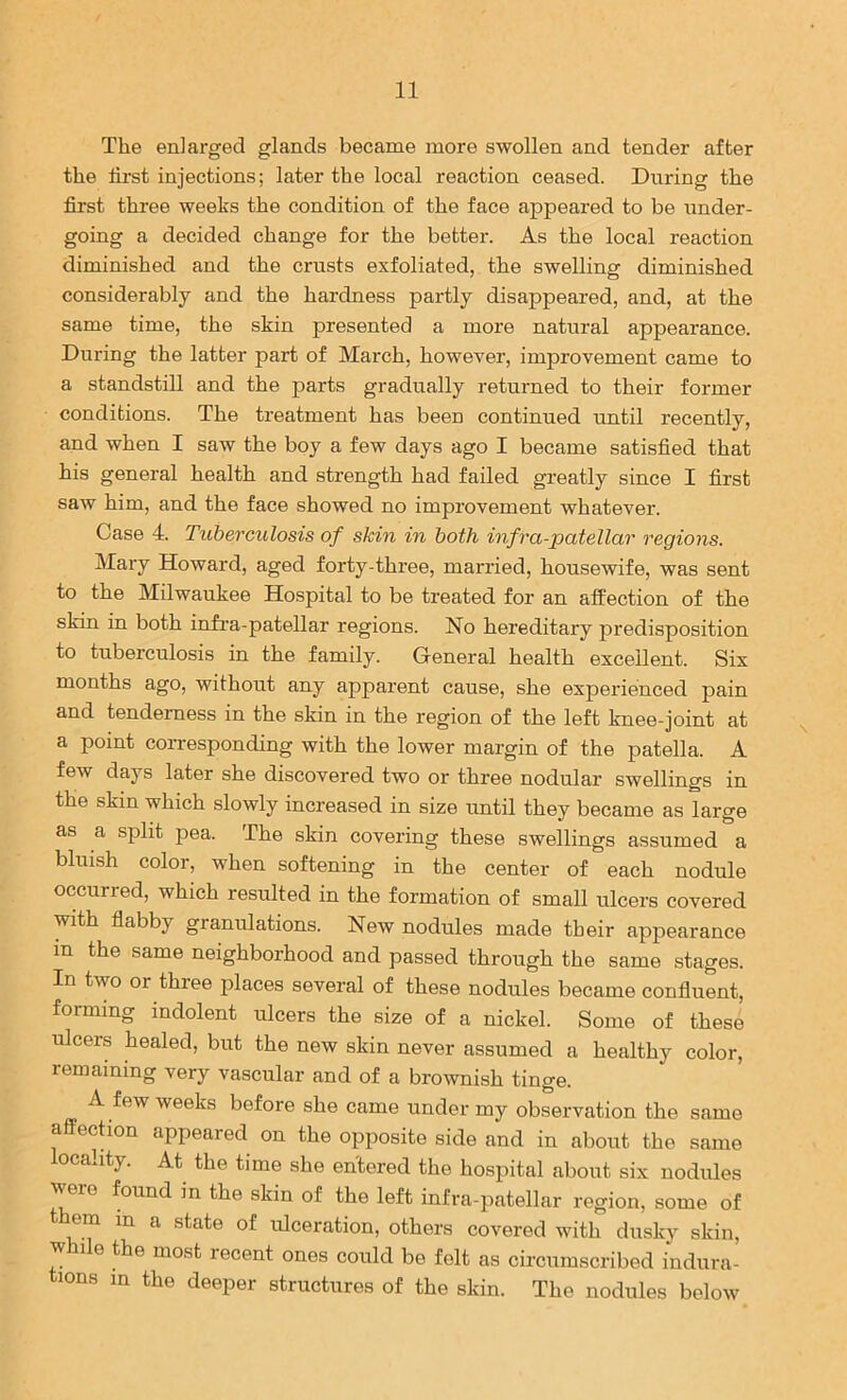 The enlarged glands became more swollen and tender after the first injections; later the local reaction ceased. During the first three weeks the condition of the face appeared to be under- going a decided change for the better. As the local reaction diminished and the crusts exfoliated, the swelling diminished considerably and the hardness partly disappeared, and, at the same time, the skin presented a more natural appearance. During the latter part of March, however, improvement came to a standstill and the parts gradually returned to their former conditions. The treatment has been continued until recently, and when I saw the boy a few days ago I became satisfied that his general health and strength had failed greatly since I first saw him, and the face showed no improvement whatever. Case 4. Tuberculosis of skin in both infra-patellar regions. Mary Howard, aged forty-three, married, housewife, was sent to the Milwaukee Hospital to be treated for an affection of the skin in both infra-patellar regions. No hereditary predisposition to tuberculosis in the family. General health excellent. Six months ago, without any apparent cause, she experienced pain and tenderness in the skin in the region of the left knee-joint at a point corresponding with the lower margin of the patella. A few days later she discovered two or three nodular swellings in the skin which slowly increased in size until they became as large as a split pea. The skin covering these swellings assumed a bluish color, when softening in the center of each nodule occurred, which resulted in the formation of small ulcers covered with flabby granulations. New nodules made their appearance in the same neighborhood and passed through the same stages. In two or three places several of these nodules became confluent, forming indolent ulcers the size of a nickel. Some of these ulcers healed, but the new skin never assumed a healthy color, lemaining very vascular and of a bro^vnish tinge. A few weeks before she came under my observation the same affection appeared on the opposite side and in about the same ocahty. At the time she entered the hospital about six nodules were found in the skin of the left infra-patellar region, some of hem m a state of ulceration, others covered with dusky skin, while the most recent ones could be felt as circumscribed indura- lons in the deeper structures of the skin. The nodules below