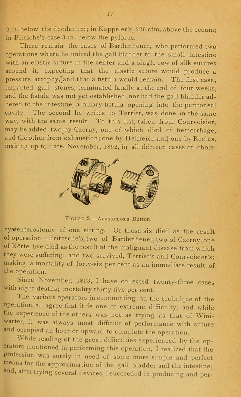 2 in. below the duodenum; in Kappeler’s, 22G ctm. above the cecum; in Fritsche’s case 3 in. below the pylorus. There remain the cases of Bardenheuer, who performed two operations where he united the gall bladder to the small intestine with an elastic suture in the center and a single row of silk sutures around it, expecting that the elastic suture would produce a pressure atrophy,^and that a fistula would remain. The first case, impacted gall stones, terminated fatally at the end of four weeks, and the fistula was not yet established, nor had the gall bladder ad- hered to the intestine, a biliary fistula opening into the peritoneal cavity. The second he writes to Terrier, was done in the same way, with the same result. To this list, taken from Courvoisier, may be added two_by Czerny, one of which died of hemorrhage, and the other from exhaustion; one by Helfreich and one by Reclus, making up to date, November, 1892, in all thirteen cases of chole- cystenterostomy of one sitting. Of these six died as the result of operation—Fritzsche’s, two of Bardenheuer, two of Czerny, one of Korte, five died as the result of the malignant disease from which they were suffering; and two survived. Terrier’s and Courvoisier’s; making a mortality of forty-six per cent as an immediate result of the operation. Since November, 1893, I have collected twenty-three cases ■with eight deaths; mortality thirty-five per cent. The various operators in commenting on the technique of the operation, all agree that it is one of extreme difficulty; and while the experience of the others was not as trying as that of Wini- warter, It was always most difficult of performance with suture and occupied an hour or upward to complete the operation. While reading of the great difficulties experienced by the op- erators mentioned in performing this operation, I realized that the profession was sorely in need of some more simple and perfect means for the approximation of the gall bladder and the intestine; and, after trying several devices, I succeeded in producing and per- Figure 2.—Anastomosis Button.