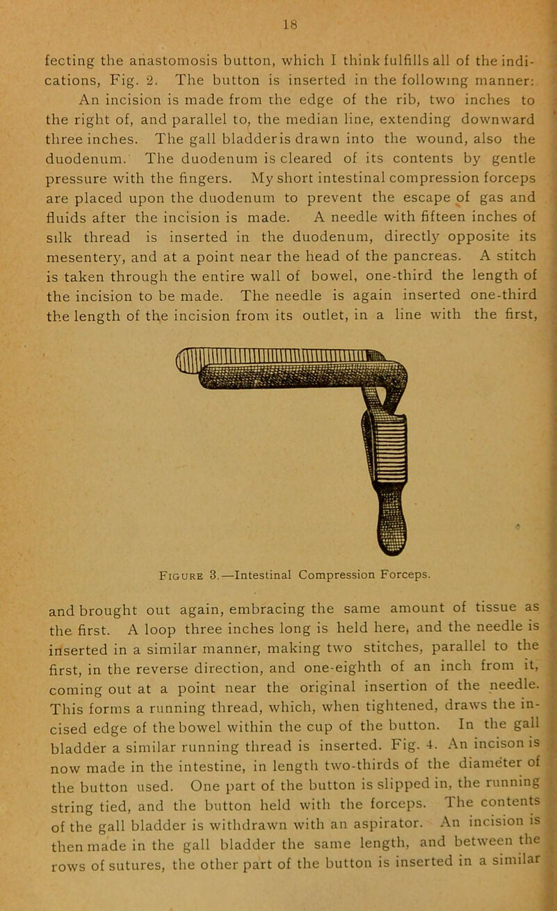 ! feeling the anastomosis button, which I think fulfills all of the indi- J cations, Fig. 2. The button is inserted in the following manner: ■ An incision is made from the edge of the rib, two inches to s the right of, and parallel to, the median line, extending downward three inches. The gall bladder is drawn into the wound, also the duodenum. The duodenum is cleared of its contents by gentle pressure with the fingers. My short intestinal compression forceps are placed upon the duodenum to prevent the escape of gas and j fluids after the incision is made. A needle with fifteen inches of silk thread is inserted in the duodenum, directly opposite its • mesentery, and at a point near the head of the pancreas. A stitch j is taken through the entire wall of bowel, one-third the length of \ the incision to be made. The needle is again inserted one-third j the length of the incision from its outlet, in a line with the first, j Figure 3.—Intestinal Compression Forceps. and brought out again, embracing the same amount of tissue as the first. A loop three inches long is held here, and the needle is inserted in a similar manner, making two stitches, parallel to the first, in the reverse direction, and one-eighth of an inch from it, coming out at a point near the original insertion of the needle. This forms a running thread, which, when tightened, draws the in- cised edge of the bowel within the cup of the button. In the gall bladder a similar running thread is inserted. Fig. 4. An incison is ; now made in the intestine, in length two-thirds of the diameter of % the button used. One part of the button is slipped in, the running ^ string tied, and the button held with the forceps. Ihe contents ^ of the gall bladder is withdrawn with an aspirator. An incision is then made in the gall bladder the same length, and between the jf rows of sutures, the other part of the button is inserted in a similar '*
