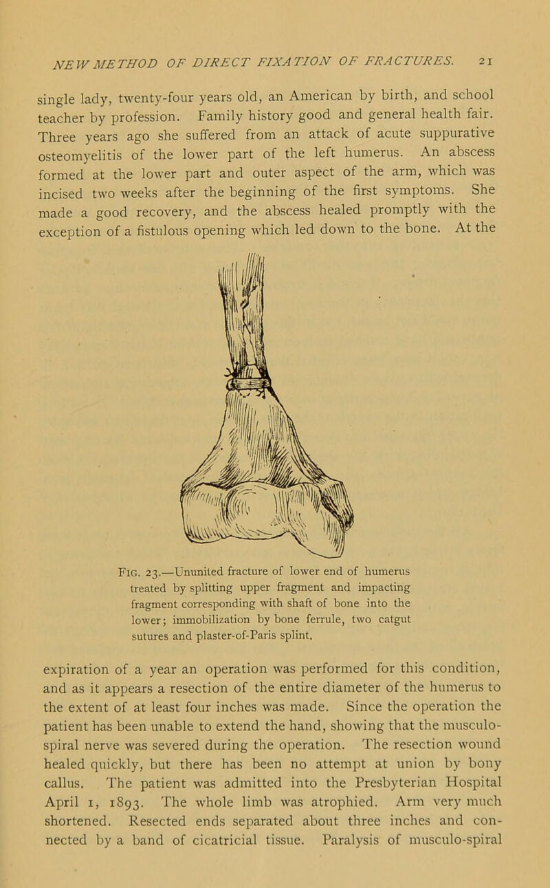 single lady, twenty-four years old, an American by birth, and school teacher by profession. Family history good and general health fair. Three years ago she suffered from an attack of acute suppurative osteomyelitis of the lower part of the left humerus. An abscess formed at the lower part and outer aspect of the arm, which was incised two weeks after the beginning of the first symptoms. She made a good recovery, and the abscess healed promptly with the exception of a fistulous opening which led down to the bone. At the Fig. 23.—Ununited fracture of lower end of humerus treated by splitting upper fragment and impacting fragment corresponding with shaft of bone into the lower; immobilization by bone ferrule, two catgut sutures and plaster-of-Paris splint. expiration of a year an operation was performed for this condition, and as it appears a resection of the entire diameter of the humerus to the extent of at least four inches was made. Since the operation the patient has been unable to extend the hand, showing that the musculo- spiral nerve was severed during the operation. The resection wound healed quickly, but there has been no attempt at union by bony callus. The patient was admitted into the Presbyterian Hospital April 1, 1893. The whole limb was atrophied. Arm very much shortened. Resected ends separated about three inches and con- nected by a band of cicatricial tissue. Paralysis of musculo-spiral