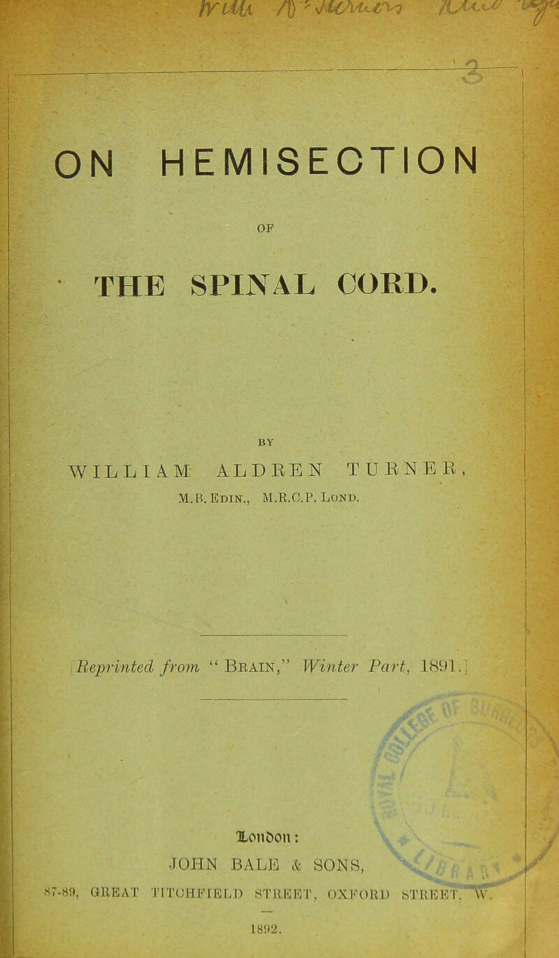 EJ2 -g—, ON HEMISECTION OF THE SPINAL CORD. WILLIAM ALD KEN TD BN EB, M.B. Edin., M.R.C.P. Lond. Reprinted from “Brain,” Winter Part, 1891. j XonCton: JOHN BALE & SONS, ^ n O -«'•», GREAT TITOHFIELD STREET, OXFORD STREET. \V. 18!)2.