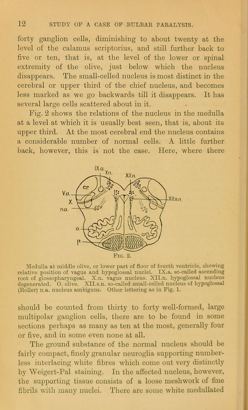 forty ganglion cells, diminishing to about twenty at the level of the calamus scriptorius, and still further hack to five or ten, that is, at the level of the lower or spinal extremity of the olive, just below which the nucleus disappears. The small-celled nucleus is most distinct in the cerebral or upper third of the chief nucleus, and becomes less marked as we go backwards till it disappears. It has several large cells scattered about in it. Fig. 2 shows the relations of the nucleus in the medulla at a level at which it is usually best seen, that is, about its upper third. At the most cerebral end the nucleus contains a considerable number of normal cells. A little further back, however, this is' not the case. Here, where there Medulla at middle olive, or lower part of floor of fourth ventricle, showing relative position of vagus and hypoglossal nuclei. IX.a. so-called ascending root of glossopharyngeal. X.n. vagus nucleus. Xll.n. hypoglossal nucleus degenerated. O. olive. XII.s.n. so-called small-celled nucleus of hypoglossal (Roller) n.a. nucleus ambiguus. Other lettering as in Fig. 1. should be counted from thirty to forty well-formed, large multipolar ganglion cells, there are to be found in some sections perhaps as many as ten at the most, generally four or five, and in some even none at all. The ground substance of the normal nucleus should be fairly compact, finely granular neuroglia supporting number- less interlacing white fibres which come out very distinctly by Weigert-Pal staining. In the affected nucleus, however, the supporting tissue consists of a loose meshwork of fine fibrils with many nuclei. There are some white medullated