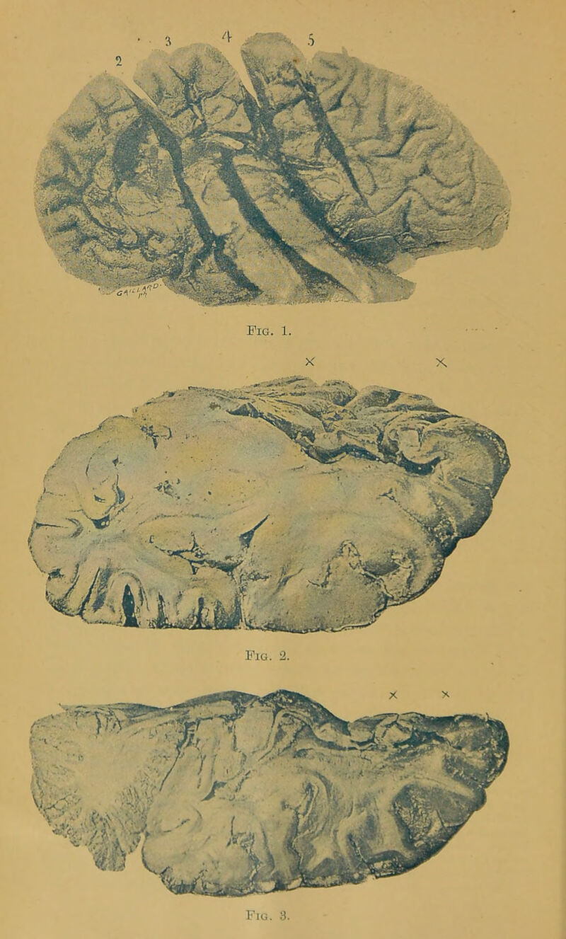 X ..V' •r^ . ; »>, .. • < ‘•v. '^Wk ■m Fig. 2.