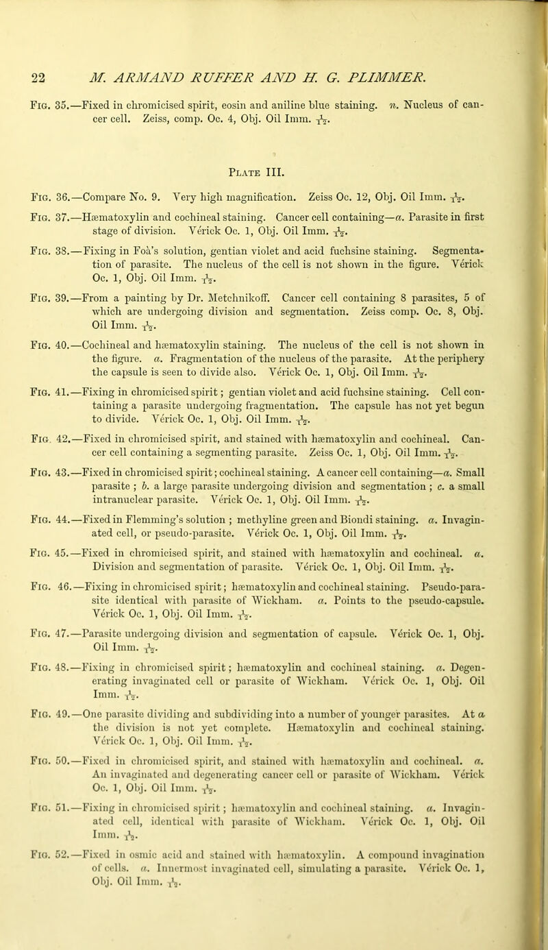 Fig. 35.—Fixed in cliromicised spirit, eosin and aniline blue staining, n. Nucleus of can- cer cell. Zeiss, comp. Oc. 4, Obj. Oil Imm. XV. Plate III. Fig. 36.—Compare No. 9. Very high magnification. Zeiss Oc. 12, Obj. Oil Imm. N- Fig. 37.—Hamiatoxylin and cochineal staining. Cancer cell containing—a. Parasite in first stage of division. Verick Oc. 1, Obj. Oil Imm. -jV. Fig. 38.—Fixing in Foa’s solution, gentian violet and acid fuclisine staining. Segmenta- tion of parasite. The nucleus of the cell is not shown in the figure. Verick Oc. 1, Obj. Oil Imm. XV. Fig. 39.—From a painting by Dr. Metchnikoff. Cancer cell containing 8 parasites, 5 of which are undergoing division and segmentation. Zeiss comp. Oc. 8, Obj. Oil Imm. XV. Fig. 40.—Cochineal and hoematoxylin staining. The nucleus of the cell is not shown in the figure, a. Fragmentation of the nucleus of the parasite. At the periphery the capsule is seen to divide also. Verick Oc. 1, Obj. Oil Imm. x\. Fig. 41.—Fixing in cliromicised spirit; gentian violet and acid fuclisine staining. Cell con- taining a parasite undergoing fragmentation. The capsule has not yet begun to divide. Verick Oc. 1, Obj. Oil Imm. E- Fig. 42.—Fixed in cliromicised spirit, and stained with liEematoxylin and cochineal. Can- cer cell containing a segmenting parasite. Zeiss Oc. 1, Obj. Oil Imm. XV Fig. 43.—Fixed in cliromicised spirit; cochineal staining. A cancer cell containing—a. Small parasite ; b. a large parasite undergoing division and segmentation ; c. a small intranuclear parasite. Verick Oc. 1, Obj. Oil Imm. XV Fig. 44.—Fixed in Flemming’s solution ; methyline green and Biondi staining, a. Invagin- ated cell, or pseudo-parasite. V4rick Oc. I, Obj. Oil Imm. [V. Fig. 45.—Fixed in cliromicised spirit, and stained with lirematoxylin and cochineal, a. Division and segmentation of parasite. Verick Oc. 1, Obj. Oil Imm. TV. Fig. 46.—Fixing in cliromicised spirit; hrematoxylin and cochineal staining. Pseudo-para- site identical with parasite of Wickham. a. Points to the pseudo-capsule. Verick Oc. I, Obj. Oil Imm. -fa. Fig. 47.—Parasite undergoing division and segmentation of capsule. Vthick Oc. 1, Obj. Oil Imm. -]V. Fig. 48.—Fixing in cliromicised spirit; lueruatoxylin and cochineal staining, a. Degen- erating invaginated cell or parasite of Wickham. Verick Oc. 1, Obj. Oil Imm. -j^r. Fig. 49.—One parasite dividing and subdividing into a number of younger parasites. At a the division is not yet complete. Hiematoxylin and cochineal staining. Verick Oc. I, Obj. Oil Imm. -jV. Fig. 50.—Fixed in cliromicised spirit, and stained with luematoxylin and cochineal, a. An invaginated and degenerating cancer cell or parasite of Wickham. Verick Oc. 1, Obj. Oil Imm. Fig. 51.—Fixing in cliromicised spirit; hannatoxylin and cochineal staining, a. Invagin- ated cell, identical with parasite of Wickham. Verick Oc. 1, Obj. Oil Imm. E- Fio. 52.—Fixed in osmic acid and stained with haematoxylin. A compound invagination of cells, a. Innermost invaginated cell, simulating a parasite. Verick Oc. 1, Obj. Oil Imm. 1l5.