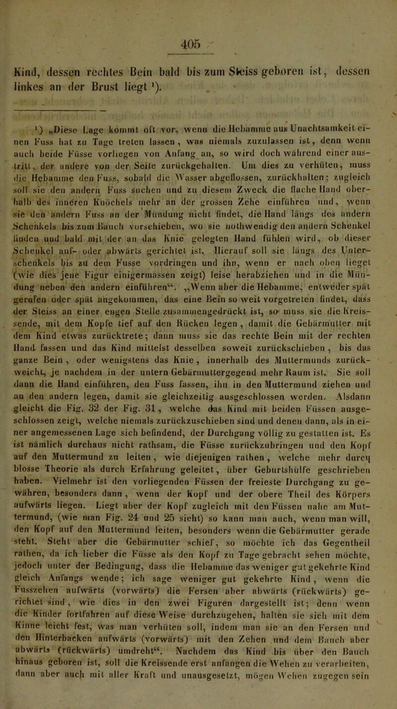 Kind, dessen rechtes Bein bald bis zuin Steiss geboren ist, dessen linkes an der Brust liegt '). l) „Diese Lage kommt oft vor, wenn die Hebamme uus Unachtsamkeit ei- nen Kuss hat 7.11 Tage treten lassen, was niemals zuzu lassen ist, denn wenn auch beide Küsse vorliegen von Anfang an, so wird doch während einer aus- trilt, der andere von der Seite zuruckgehalten. Um dies zu verhüten, muss die Hebamme den Kuss, sobald die Wasser abgeflossen, zurückhalten; zugleich soll sie den andern Kuss suchen und zu diesem Zweck die Hache Hand ober- halb des inneren Knöchels mehr an der grossen Zehe einrühren und, wenn sie den andern Kuss nn der Mündung nicht findet, die Hand längs dos andern Schenkels bis zum Bauch vorschieben, wo sie nothwendig den andern Schenkel linden uud bald mit der an das knie gelegten Hand fühlen wird, ob dieser Scheukcl auf- oder abwärts gerichtet ist. Hierauf soll sie längs des Unter- schenkels bis zu dem Kusse Vordringen und ihn, wenn er nach oben lieget (wie dies jene Kigur einigermassen zeigt) leise herabziehen und in die Mün- dung neben den andern einführen“. „Wenn aber die Hebamme, entweder spät gerufen oder spät angekommen, das eine Bein so weit vorgelrelen findet, dass der Steiss an einer engen Stelle zusammengedrückt ist, so muss sie die Kreis— sende, mit dem Kopfe tief auf den Kücken legen , damit die Gebärmutter mit dem Kind etwas zurücktrete; dann muss sie das rechte Bein mit der rechten Hand fassen und das Kind mittelst desselben soweit zurückschieben , bis das ganze Bein, oder wenigstens das Knie, innerhalb des Muttermunds zurück- weicht, je nachdem in der untern Gebürmutlergegend mehr Kaum ist. Sie soll dann die Hand einführen, den Kuss fassen, ihn in den Muttermund ziehen und an den andern legen, damit sie gleichzeitig ausgeschlossen werden. Alsdann gleicht die Kig. 32 der Kig. 31, welche das Kind mit beiden Küssen ausge- schlossen zeigt, welche niemals zurückzuschieben sind und denen dann, als in ei- ner angemessenen Lage sieb befindend, der Durchgang völlig zu gestalten ist. Es ist nämlich durchaus nicht rathsam, die Küsse zurückzubringen und den Kopf auf den Muttermund zu leiten, wie diejenigen rathen, welche mehr durc<| blosse Theorie als durch Erfahrung geleitet, über Geburtshülfe geschrieben haben. Vielmehr ist den vorliegenden Füssen der freieste Durchgang zu ge- währen, besonders dann, wenn der Kopf und der obere Theil des Körpers aufwärts liegen. Liegt aber der Kopf zugleich mit den Küssen nahe am Mut- termund, (wie man Kig. 24 und 25 sieht) so kann man auch, wenn man will, den Kopf auf den Muttermund leiten, besonders wenn die Gebärmutter gerade steht. Steht aber die Gebärmutter schief, so möchte ich das Gegcntheil rathen, da ich lieber die Küsse als den Kopf zu Tage gebracht sehen möchte, jedoch unter der Bedingung, dass die Hebamme das weniger gut gekehrte Kind gleich Anfangs wende; ich sage weniger gut gekehrte Kind, wenn die Kusszehen aufwärts (vorwärts) die Fersen aber abwärts (rückwärts) ge- richtet sind, wie dies in den zwei Figuren dargestellt ist; denn wenn die Kinder fortfahren auf diese Weise durchzugehen, halten sie sich mit dem Kinne leicht fest, was man verhüten soll, indem man sie an den Fersen und den Hinterbacken aufwärts (vorwärts) mit den Zehen und dem Bauch aber abwärts (rückwärts) umdreht“. Nachdem das Kind bis über den Bauch hinaus geboren ist, soll die Kreissende erst anlängen die Wehen zu verarbeiten, dann aber aueji mit aller Kraft und unausgesetzt, mögen Wehen zugegen sein