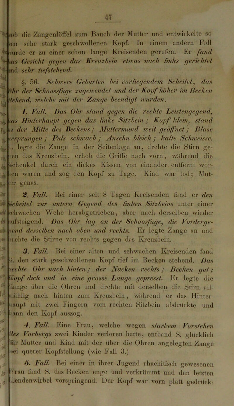 •a» ,ol) die Zangenlöffel zum Bauch der Mutter und entwickelte so <en sehr stark geschwollenen Kopf. In einem andern Fall 4s urde er zu einer schon lange Kreisenden gerufen. Er fand '-ms Gesicht gegen das Kreuzbein etwas nach links (jerichtet md sehr iiefstehend. §. 56. Schwere Geburten bei vorliegendem Scheitel, das Ihr der Schoossfuge zugewendet und der Kopf höher im Hecken tfehend, welche mit der Zange beendigt wurden. ff®. 4 IV n- ■döB 4 >in U äff E| Ht k ieifc 4 1. Falt. Das Ohr stand gegen die rechte Leistengegend, as Hinterhaupt gegen das Unke Sitzbein ; Kopf klein, stand i der Mitte des Beckens; Muttermund weit geöffnet; /Hase • esprungen ; Puls schwach ; Ansehn bleich ; kalte Schwcisse. .. legte die Zange in der Seitenlage an, drehte die Stirn ge- cen das Kreuzbein, erhob die Griffe nach vorn, während die 'lichcnkel durch ein dickes Kissen von einander entfernt wei- ten waren und zog den Kopf zu Tage. Kind war tod; Mut- it genas. 2. Fall. Bei einer seit 8 Tagen Kreisenden fand er den Scheitel zur untern Gegend des linken Sitzbeins unter einer ich wachen Wehe herabgetrieben, aber nach derselben wieder uFteigend. Das Ohr lag an der Schuusfuge, die Vorderge- end desselben nach oben und rechts. Er legte Zange an und relite die Stirne von rcohts gegen das Kreuzbein. 3. Fall. Bei einer alten und schwachen Kreisenden fand 4. den stark geschwollcneu Kopf tief im Becken stehend. Das aichte Ohr nach hinten; der Nacken rechts; Decken gut; Kopf dick und in eine grosse Länge gepresst. Er legte die '.hinge über die Ohren und drehte mit derselben die Stirn all- 1 mählig nach hinten zum Kreuzbein, während er das Hinter- 1 ^ iiaupt mit zwei Fingern vom rechten Sitzbein abdrückte und ann den Kopf auszog. r\l-* ’ti* n m .cf 4. Fall. Eine Frau, welche wegen starkem Vorstehen Hes Vorbergs zwei Kinder verloren hatte, entband S. glücklich iir Mutter und Kind mit der über die Ohren angelegten Zange »ei querer Kopfstcllung (wie Fall 3.) 5. Falt. Bei einer in ihrer Jugend rhachitisch gewesenen 'Tau fand S. das Becken enge und verkrümmt und den letzten Lendenwirbel vorspringend. Der Kopf war vorn platt gedrüek-