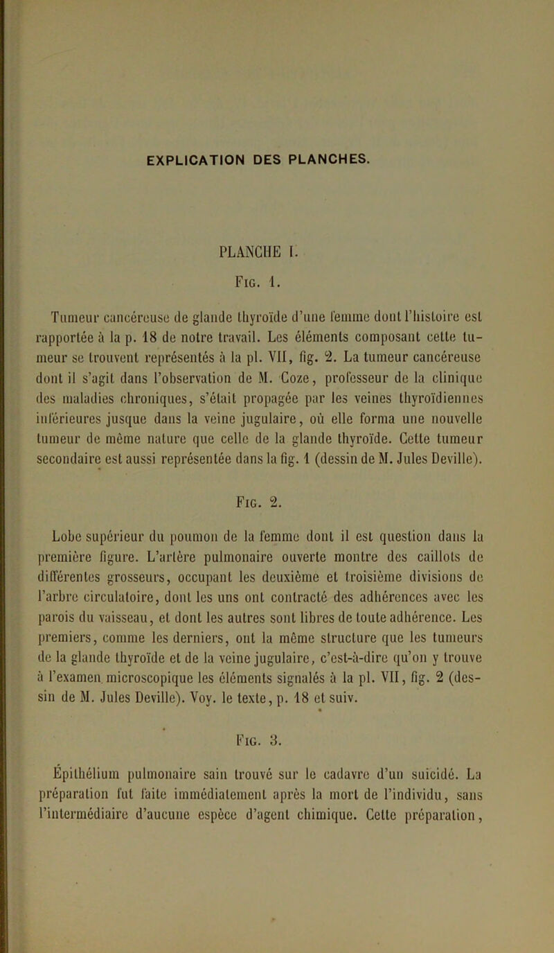 PLANCHE I. Fig. 1. Tumeur cancéreuse de glande Ihyroïde d’une femme dont l’Iiisloire est rapportée à la p. 18 de notre travail. Les éléments composant cette tu- meur se trouvent représentés à la pl. VII, fig. 2. La tumeur cancéreuse dont il s’agit dans l’observation de M. Coze, professeur de la clinique des maladies chroniques, s’était propagée par les veines thyroïdiennes inférieures jusque dans la veine jugulaire, où elle forma une nouvelle tumeur de même nature que celle de la glande thyroïde. Celle tumeur secondaire est aussi représentée dans la fig. 1 (dessin de M. Jules Deville). Fig. 2. Lobe supérieur du poumon de la femme dont il est question dans la première figure. L’arlère pulmonaire ouverte montre des caillots de différentes grosseurs, occupant les deuxième et troisième divisions de l’arbre circulatoire, dont les uns ont contracté des adhérences avec les parois du vaisseau, et dont les autres sont libres de toute adhérence. Les premiers, comme les derniers, ont la même structure que les tumeurs de la glande thyroïde et de la veine jugulaire, c’est-à-dire qu’on y trouve à l’examen microscopique les éléments signalés à la pl. VII, fig. 2 (des- sin de M. Jules Deville). Voy. le texte, p. 18 et suiv. Fig. 3. Épithélium pulmonaire sain trouvé sur le cadavre d’un suicidé. La préparation lut faite immédiatement après la mort de l’individu, sans l’intermédiaire d’aucune espèce d’agent chimique. Celle préparation,